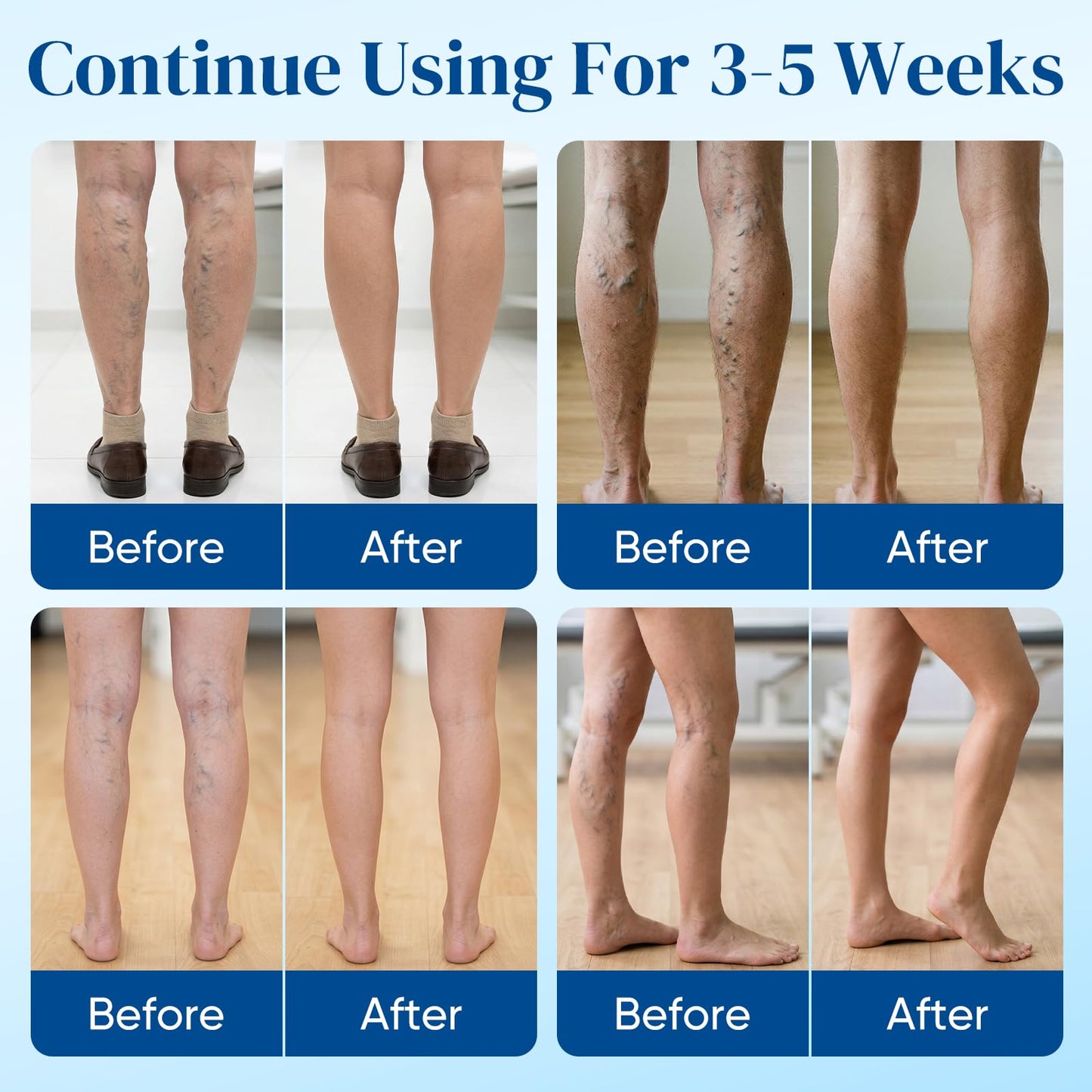 2Box Vein Target Microdarts Patch, Professional Varicose Veins Treatment for Legs, Improves Blood Circulation, Natural Ingredients Varicose Vein Patches for All Skin Types