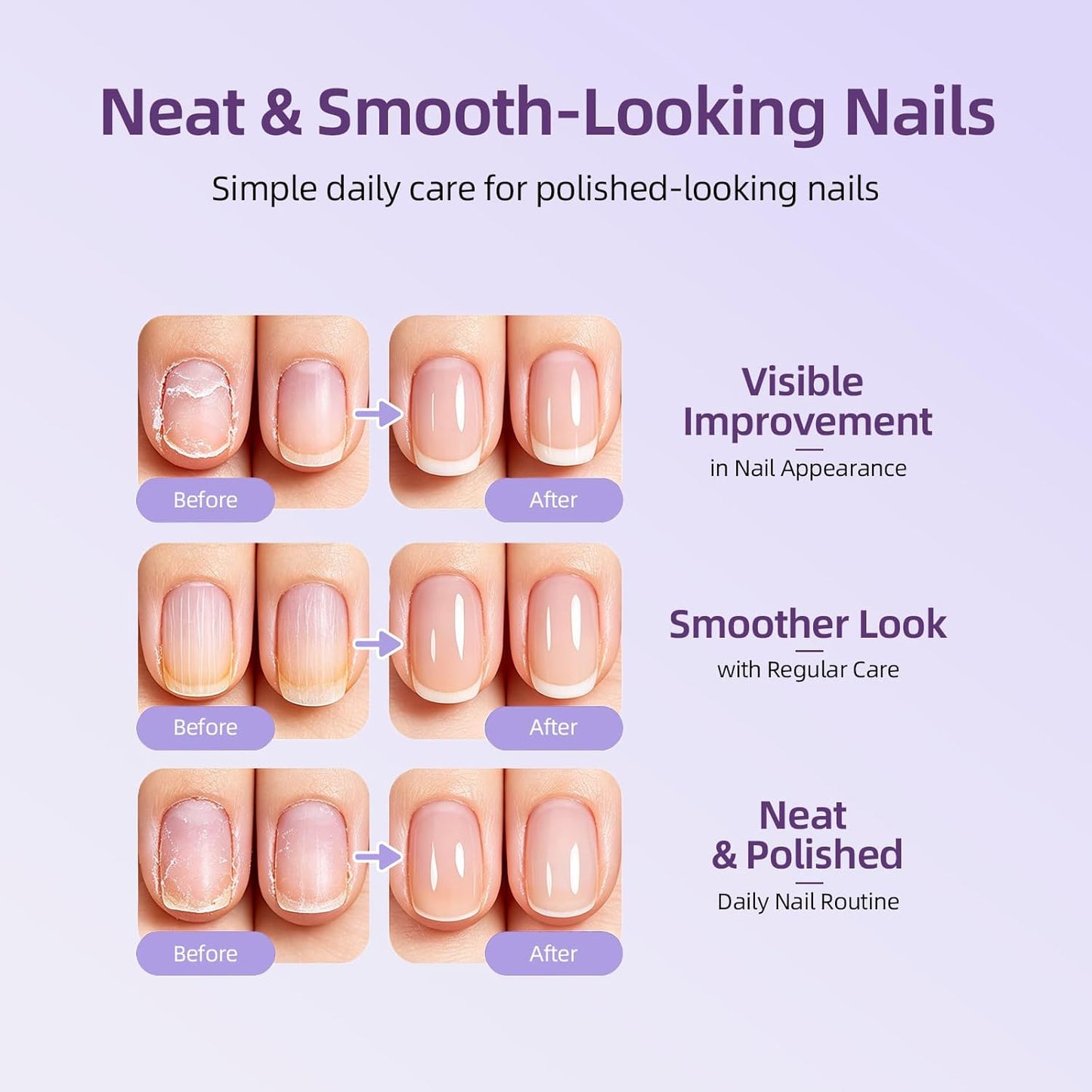 Cuticle Oil Pusher Pen - 2-in-1 Ceramic Nail Care Tool for Dry Nails & Hangnails | Moisturizing Remover (1pc)