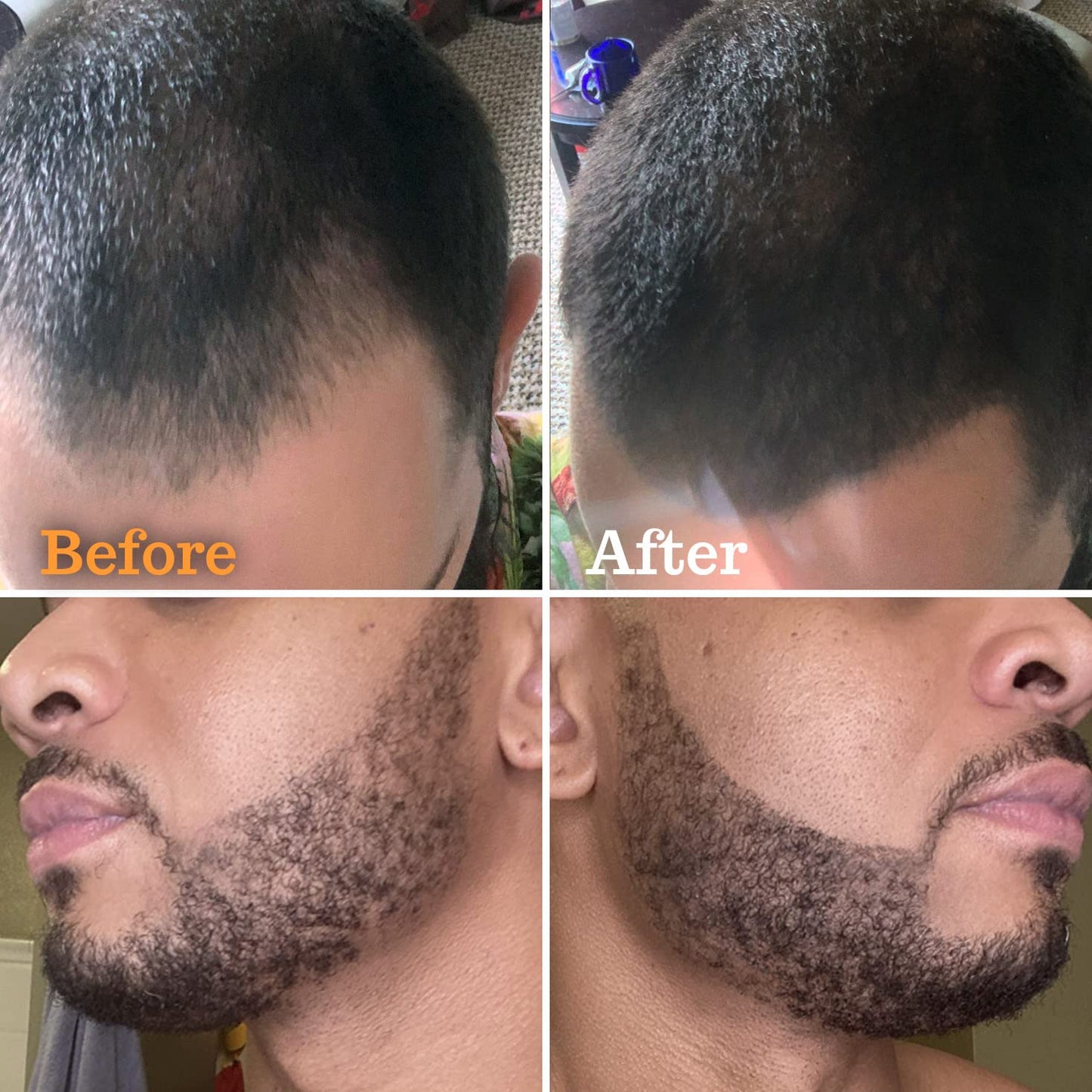 FOLLICLE BOOSTER Beard Pen Filler Styling Kit for Men - 3-in-1 Filling Set with 4-Tip Fork, Normal Pencil, and Brush - Waterproof, Sweatproof & All-Day Hold - Medium Brown