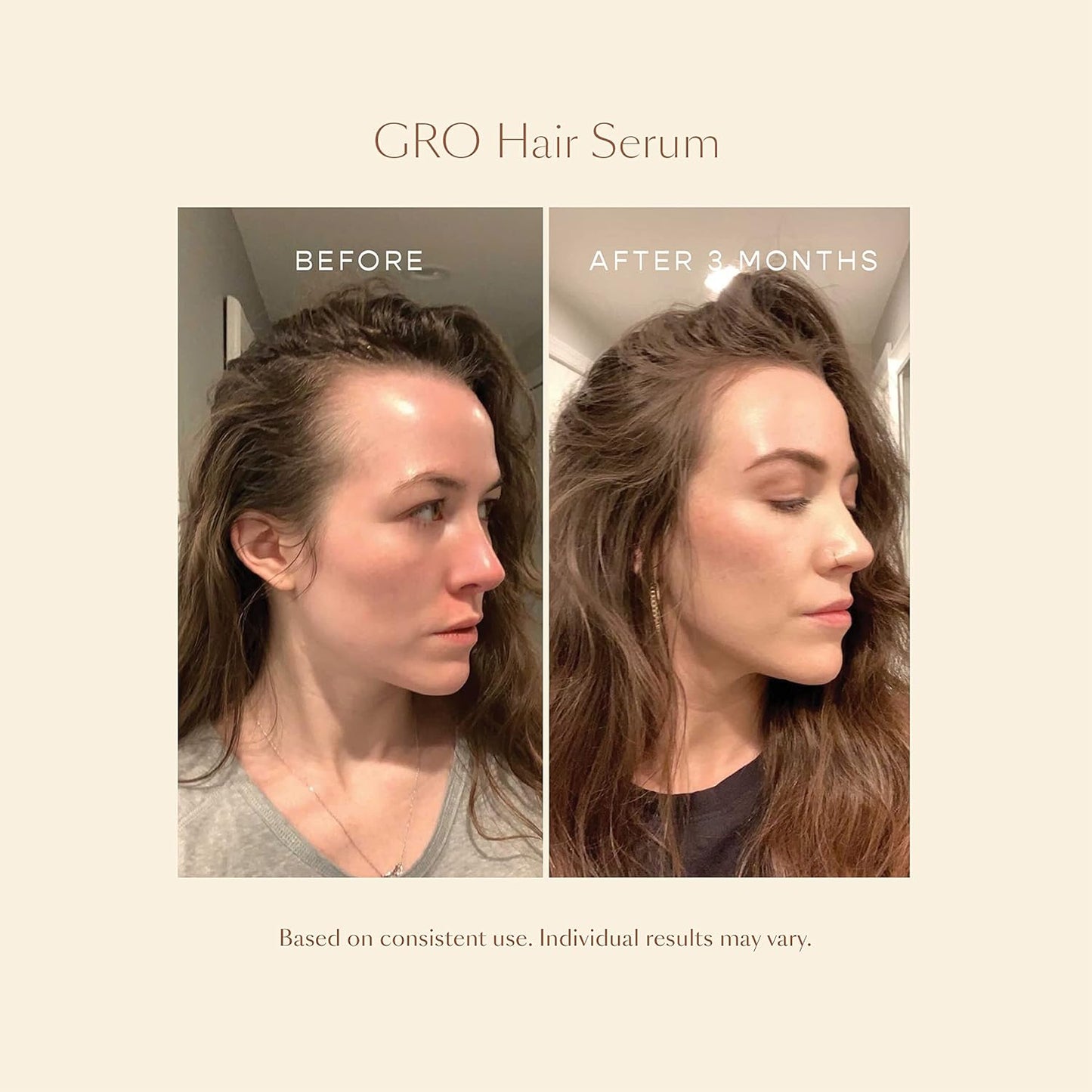 GRO More Kit - Hair Growth Serum & Gummies for Volumized Hair | Nourishing Formula