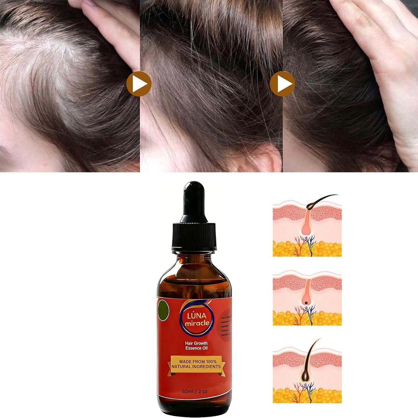 Luna Miracle Hair Growth Oil - 100% Natural Essence for Frizzy & Damaged Hair | 2 Ounce (2PCS)