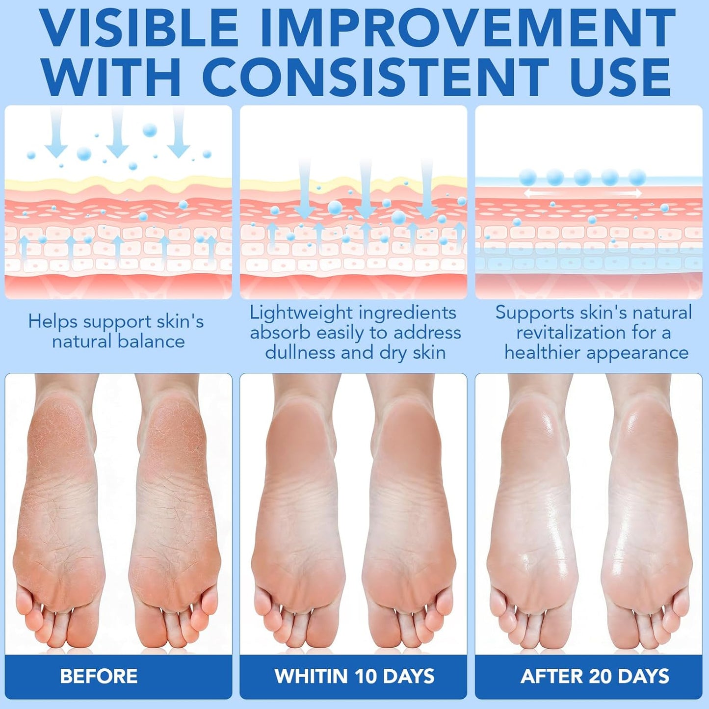 Urea Foot Care Stick with 2% Salicylic Acid | Intensive Moisturizing Cream for Dry, Cracked Feet - 1.41 oz