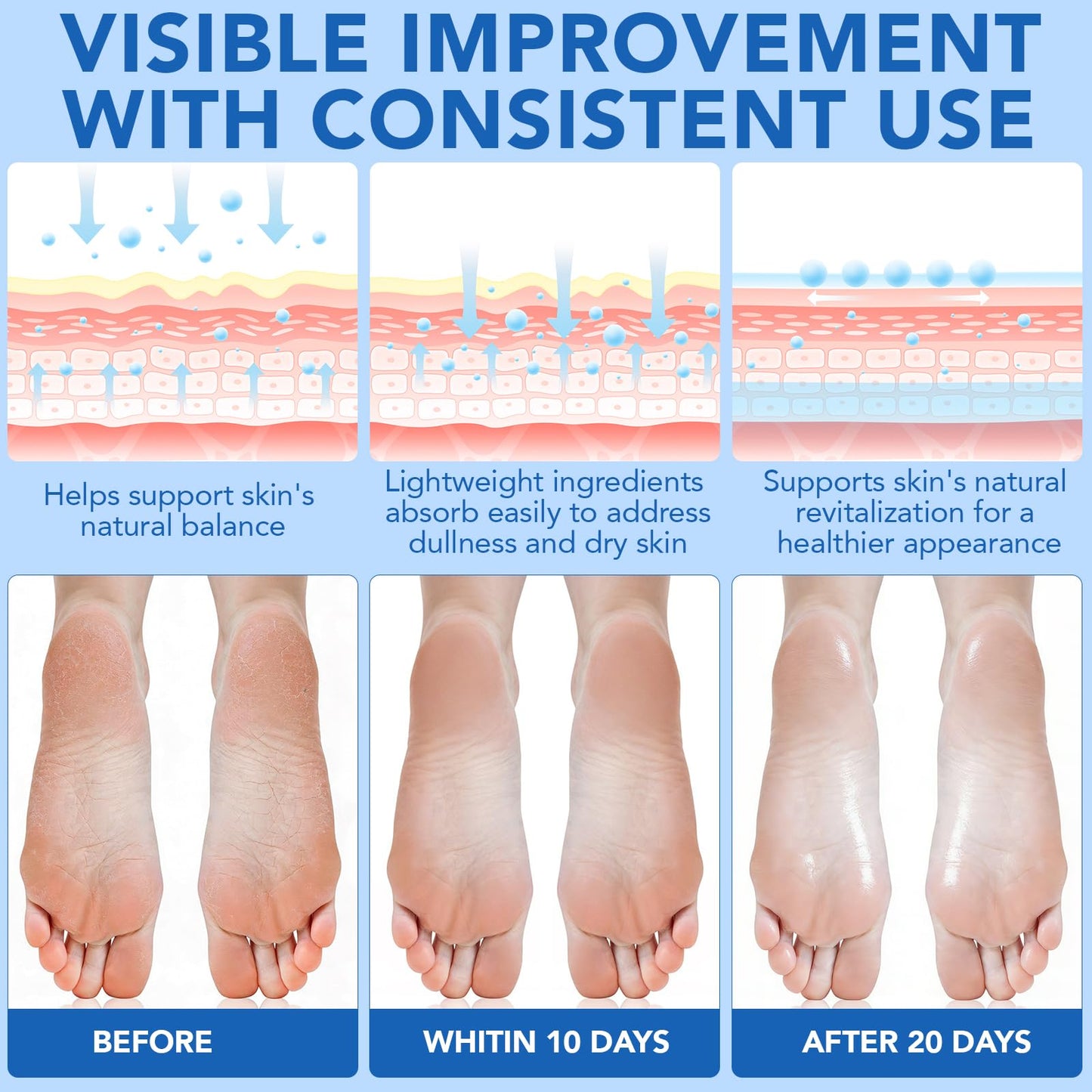 Urea Cream 60% with Salicylic Acid 2% Urea Foot Care Stick, Foot Cream for Dry Cracked Feet, Heels, Knees, Hands, Elbows, Feet Moisturizer Stick for Callus Remover & Skin Softener (40g (Pack of 2))