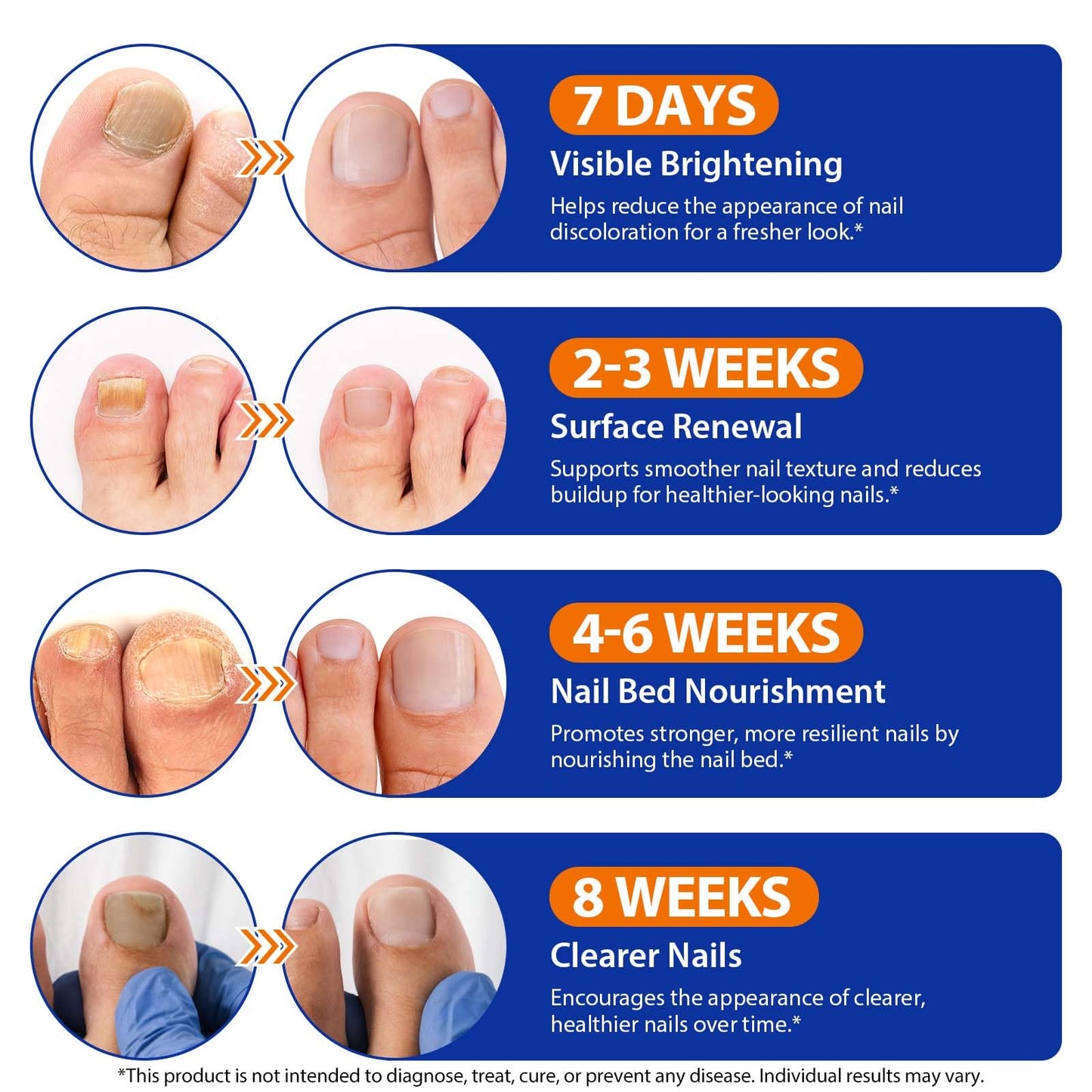 Nail Care Extra Strength - 32 Pcs Nighttime Nail Patches, Overnight Toe Nail Care for a Healthy Appearance, 8-Hour Moisturizing & Nourishing for Toenail, Suitable for Women & Men (1PC)