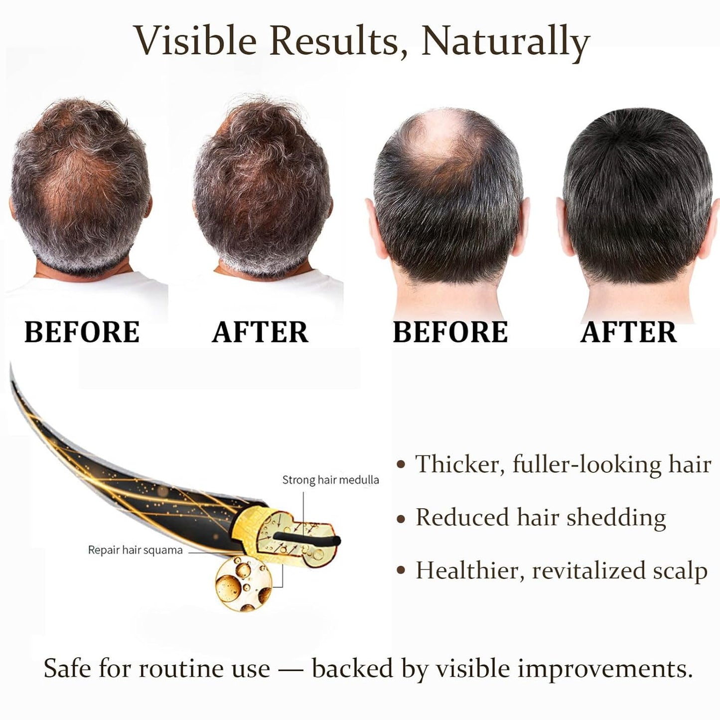 Advanced Hair Regrowth System - Ginseng & Peppermint Oil Treatment for Thicker Hair | Unisex Serum (1)