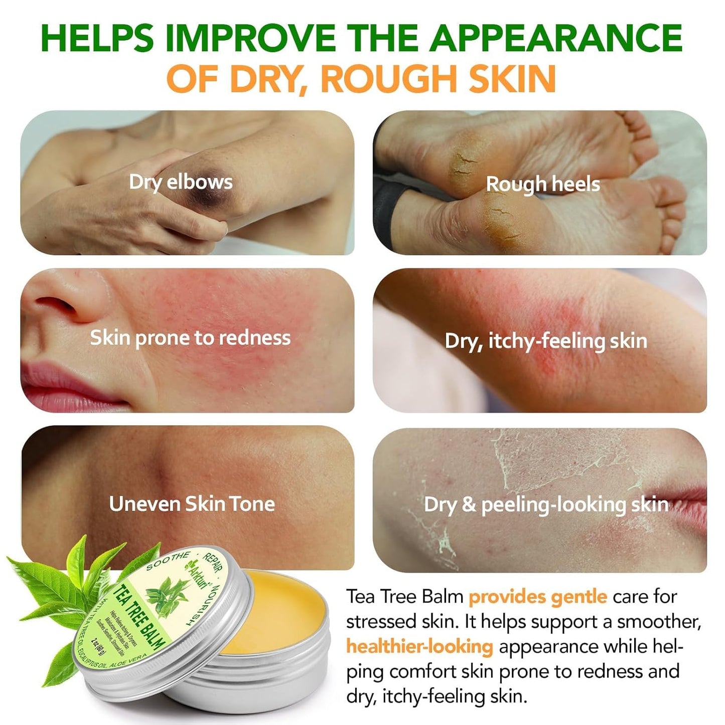Tea Tree Oil Balm for Dry Skin Relief | Organic & Safe for All Ages - 1 Pack