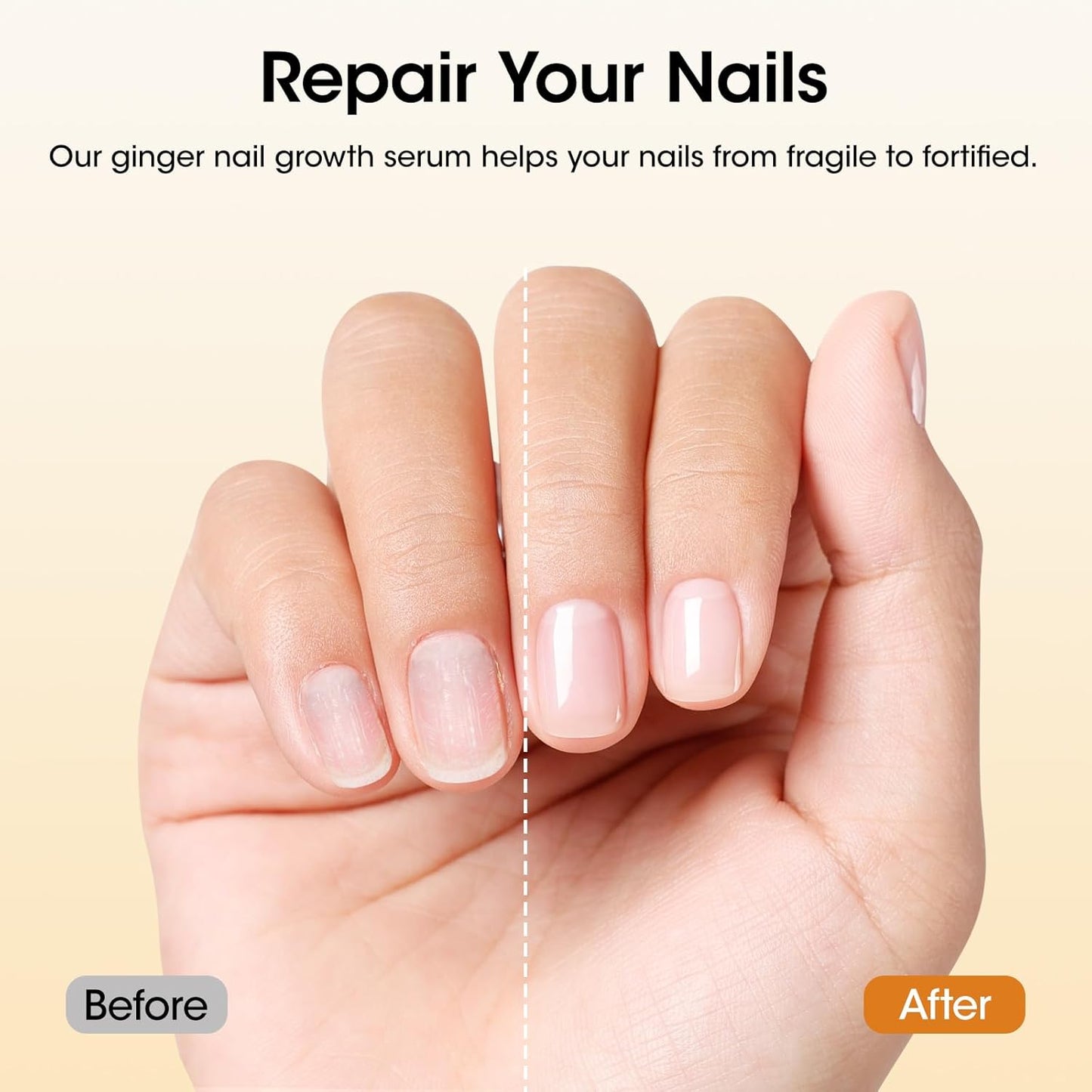 Gellen Ginger Nail Growth Serum - Strengthen & Repair Weak, Brittle Nails | 7-14 Days Treatment