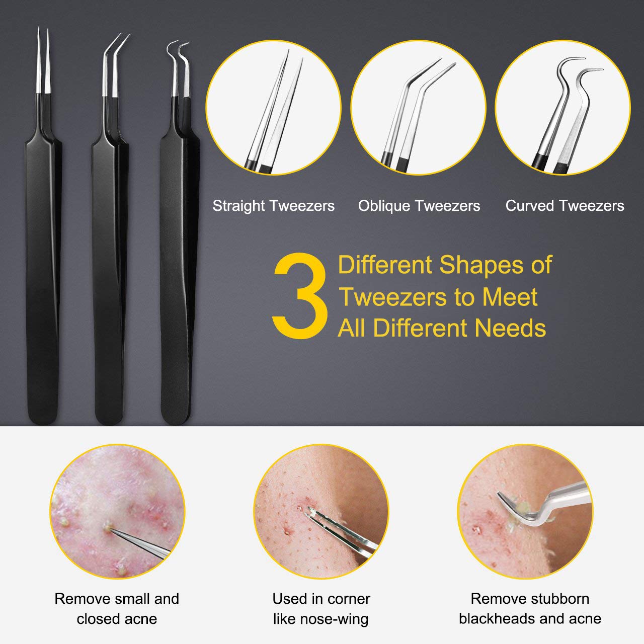 Pimple Popper Tool Kit - 10-Piece Blackhead Remover & Comedone Extractor Set | Easy Pimple & Zit Removal (Black)