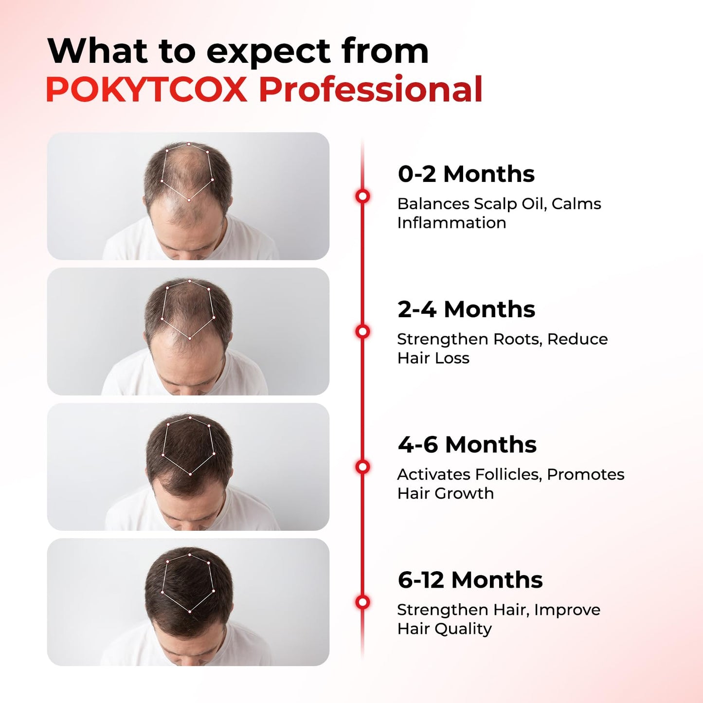 Laser Red Light Therapy for Hair Growth,FDA Cleared Hair Growth Device for Men & Women,650nm Low Level Laser Therapy for Thinning Hair & Alopecia, 200 Lasers Full Scalp Coverage Home Use(KCA451-200S)
