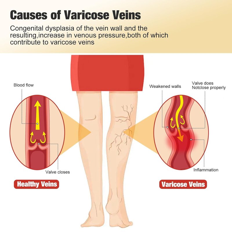 Varicose Veins Patch - 36PCS Turmeric Treatment for Legs | Natural Spider Vein Relief & Enhanced Circulation