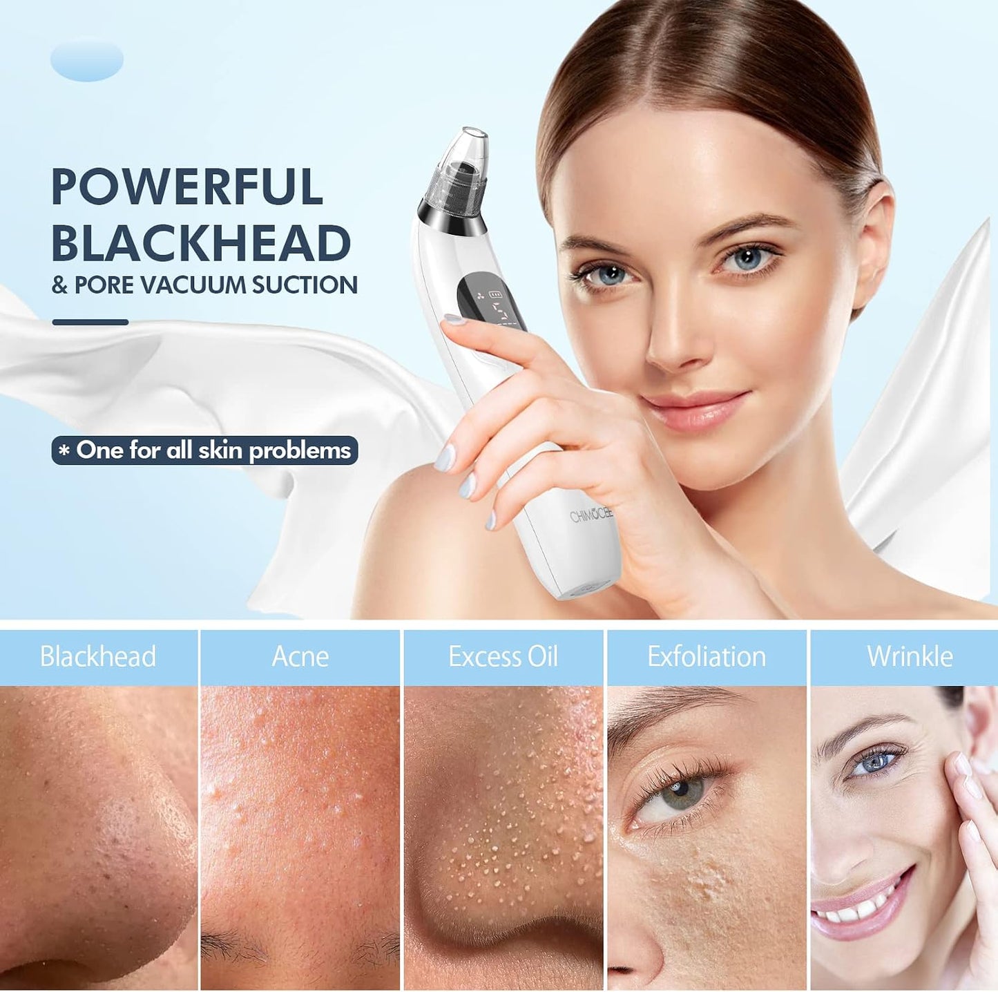 Blackhead Remover Vacuum - Electric Pore Cleaner with 5 Suction Levels & Probes | USB Rechargeable Acne Tool Kit