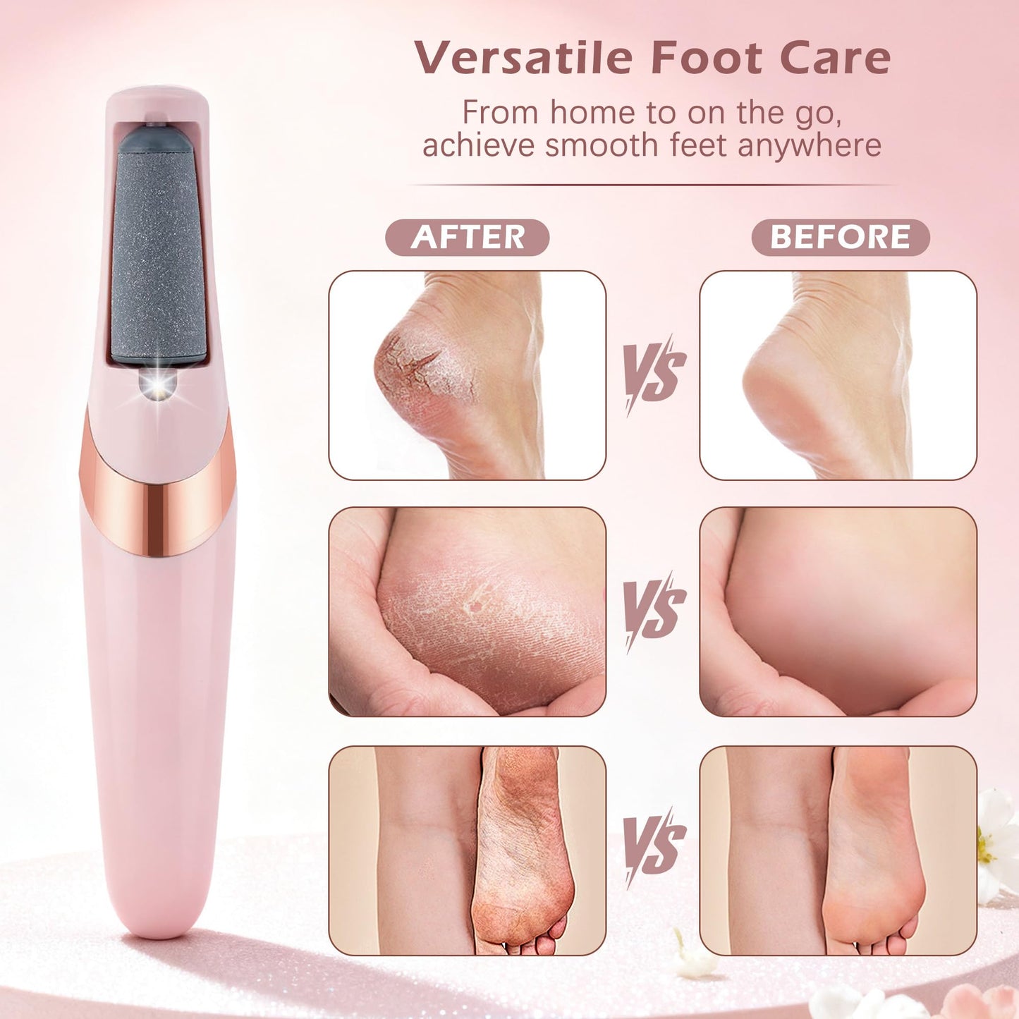 IRILEKI Rechargeable Electric Callus Remover for Feet, 2 Gears Foot Callus Remover with 2 Replaceable Rollers, Portable Foot File Callus Remover for Smooth Heels at Home or Travel (Pink)