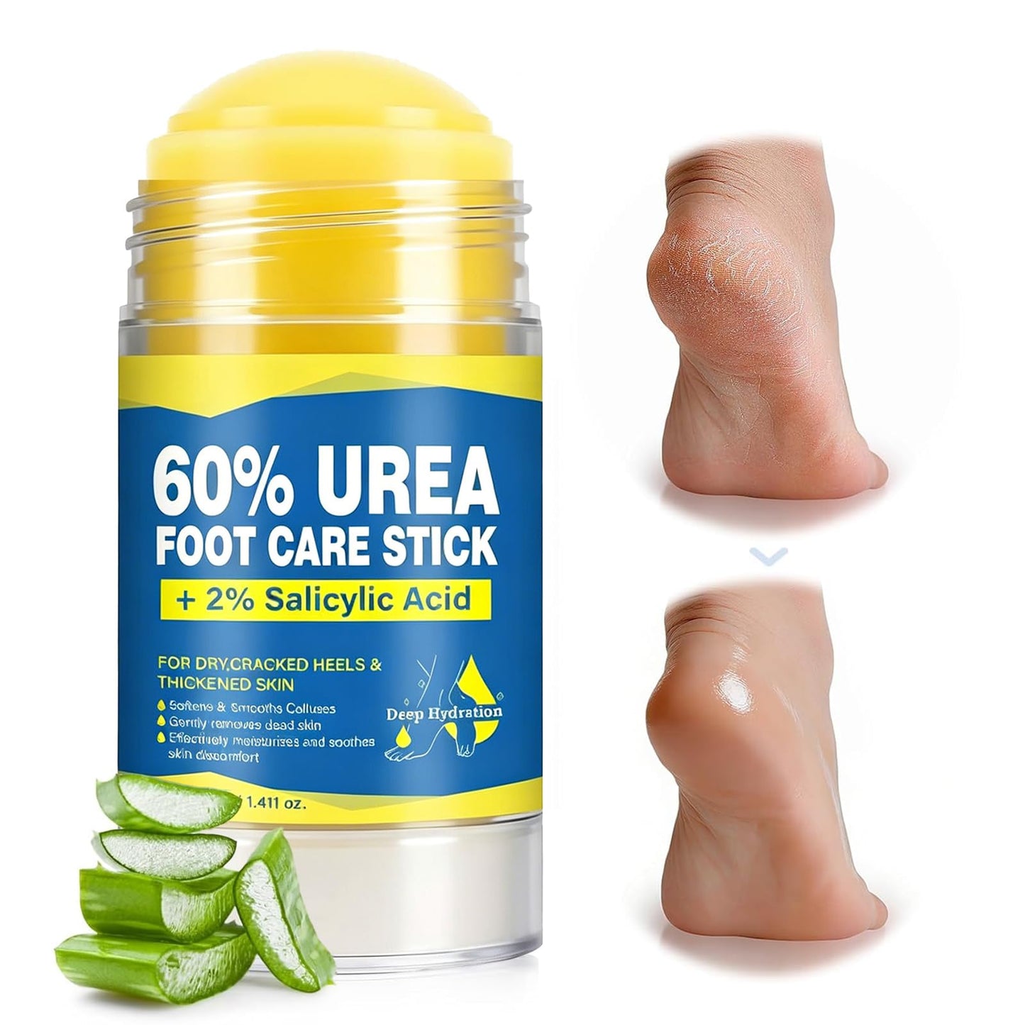 QVCQ 60% Urea Foot Cream Stick with 2% Salicylic Acid, Intensive Heel Balm for Dry Cracked Feet, Rough and Thick Skin, Fast-Absorbing Foot Repair Moisturizer for Heels, Elbows and Knees, 1.41 Oz