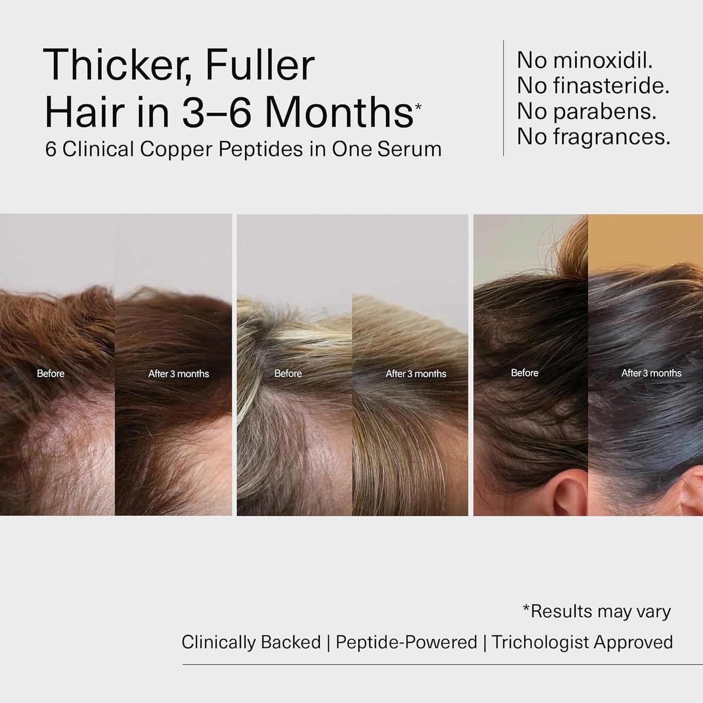 Bloom Copper GHK-CU Peptide Hair Serum for Hair Growth - Non-Greasy & Lightweight | 3-Pack for 3 Months Supply