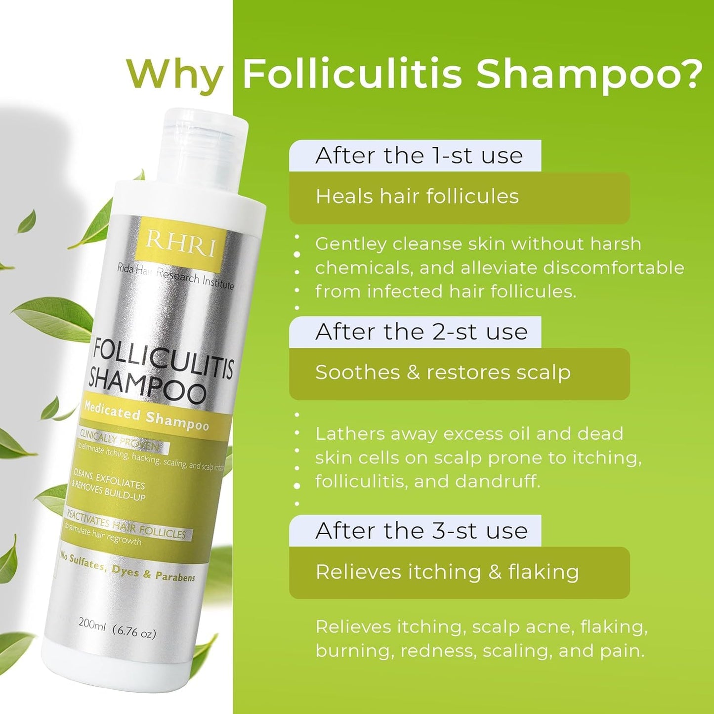 Folliculitis Shampoo - Antifungal Treatment for Seborrheic Dermatitis & Scalp Psoriasis | Soothes Itchy, Dry Scalp