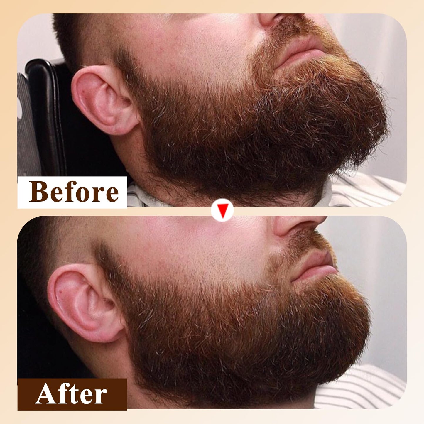 Varolan Mens Beard Oil Capsules,Natural Beard Oil for Men,Naturally Ingredients with Argan Oil,Grapeseed Oil,Jojoba Oil and Vitamin E for Softening and Moisturizing Beard (Cedarwood)