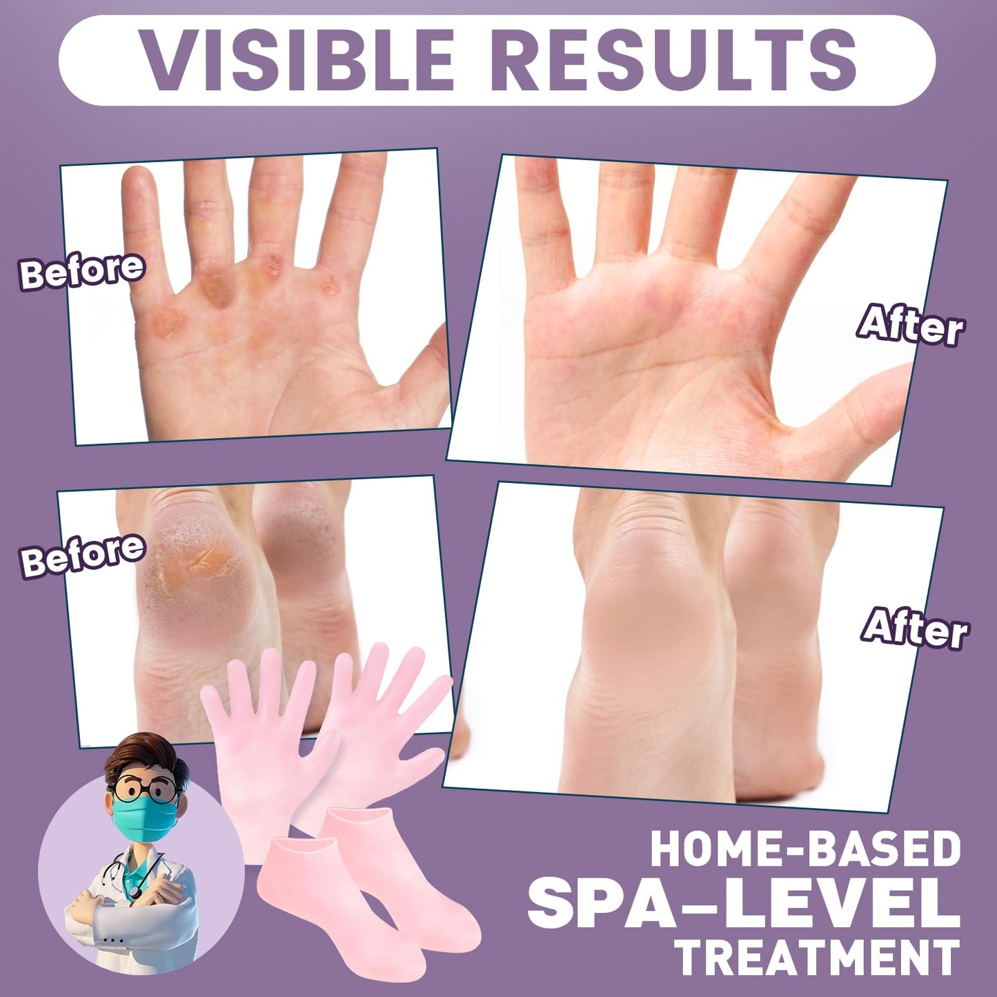 4 Pairs Silicone Socks Gloves Set for Dry Cracked Feet and Hands, Size 10