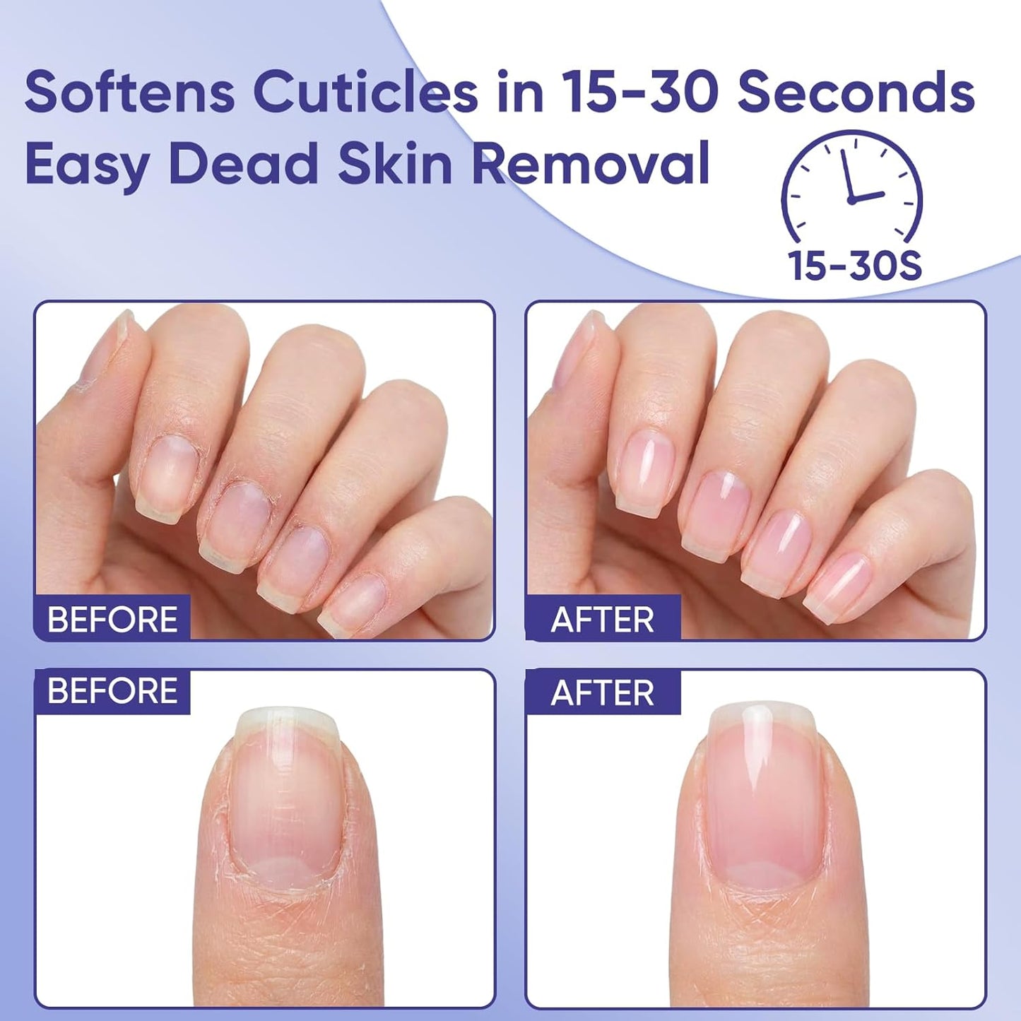 Cuticle Remover Gel & Strengthening Nail Oil Pen - Salon-Perfect Nails at Home | 15 Seconds to Beautiful Nails