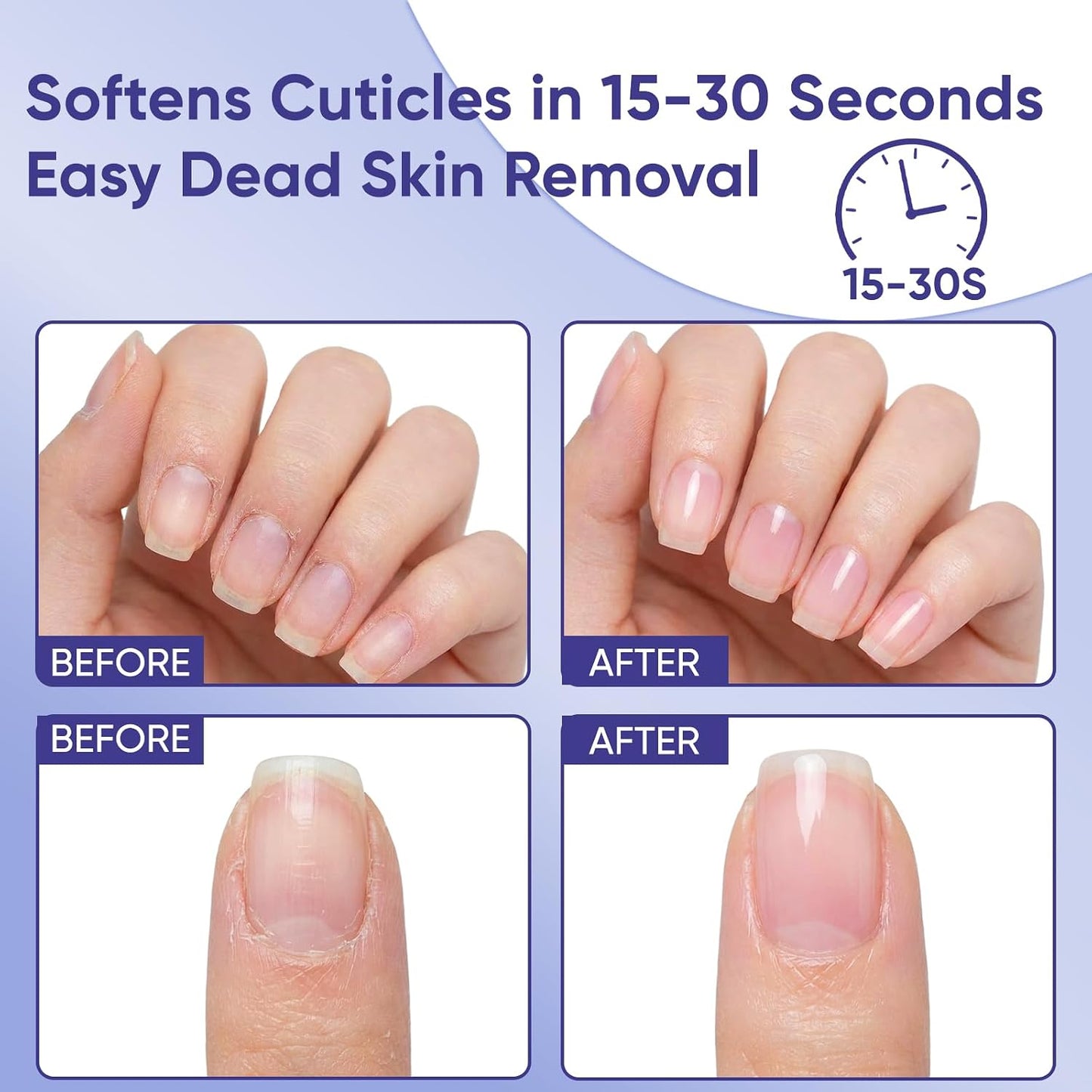 Cuticle Remover Gel & Nail Strengthening Oil Pen - Salon-Perfect Nails at Home | Gel & Lemon