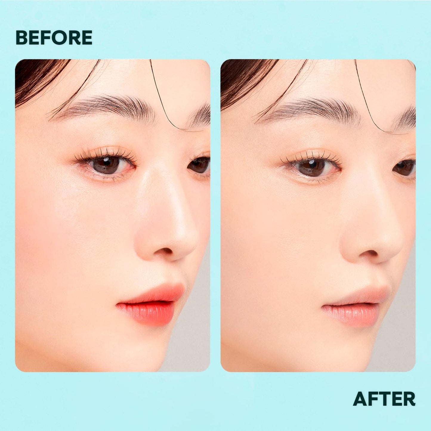 Vacure:treat Micellar Water, Gentle Facial Cleanser & Makeup Remover for Adults, Cleansing & Moisturizing, Suitable for All Skin Type, Natural Ingredients, Postbiotics, Panthenol 8.45 Fl. Oz, 1 Count