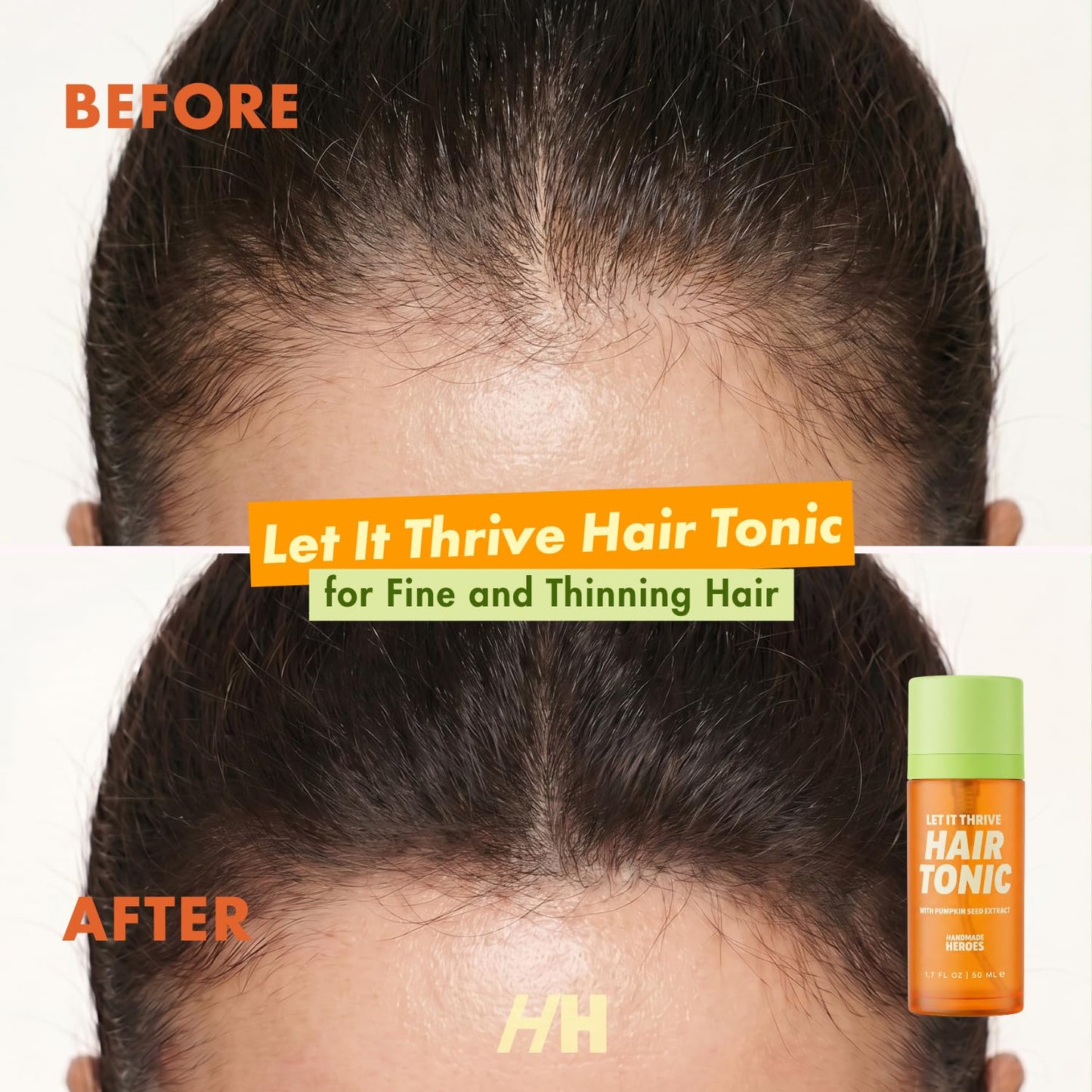 Handmade Heroes 100% Natural Rosemary Hair Tonic with Pumpkin Seed Extract for Hair Thinning - Hair Tonic for Men and Women - Thickening and Lusher Looking Hair