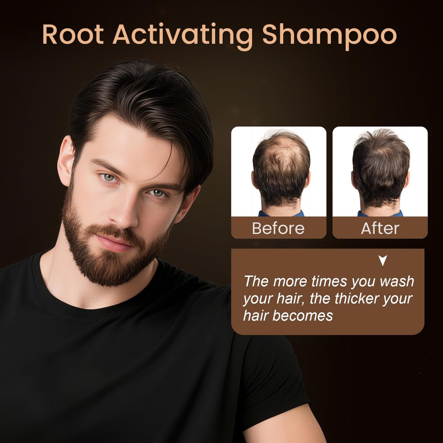 300ML Root Activator Shampoo For Men & Women, Hair Growth Shampoo for Hair Loss and Thinning Hair