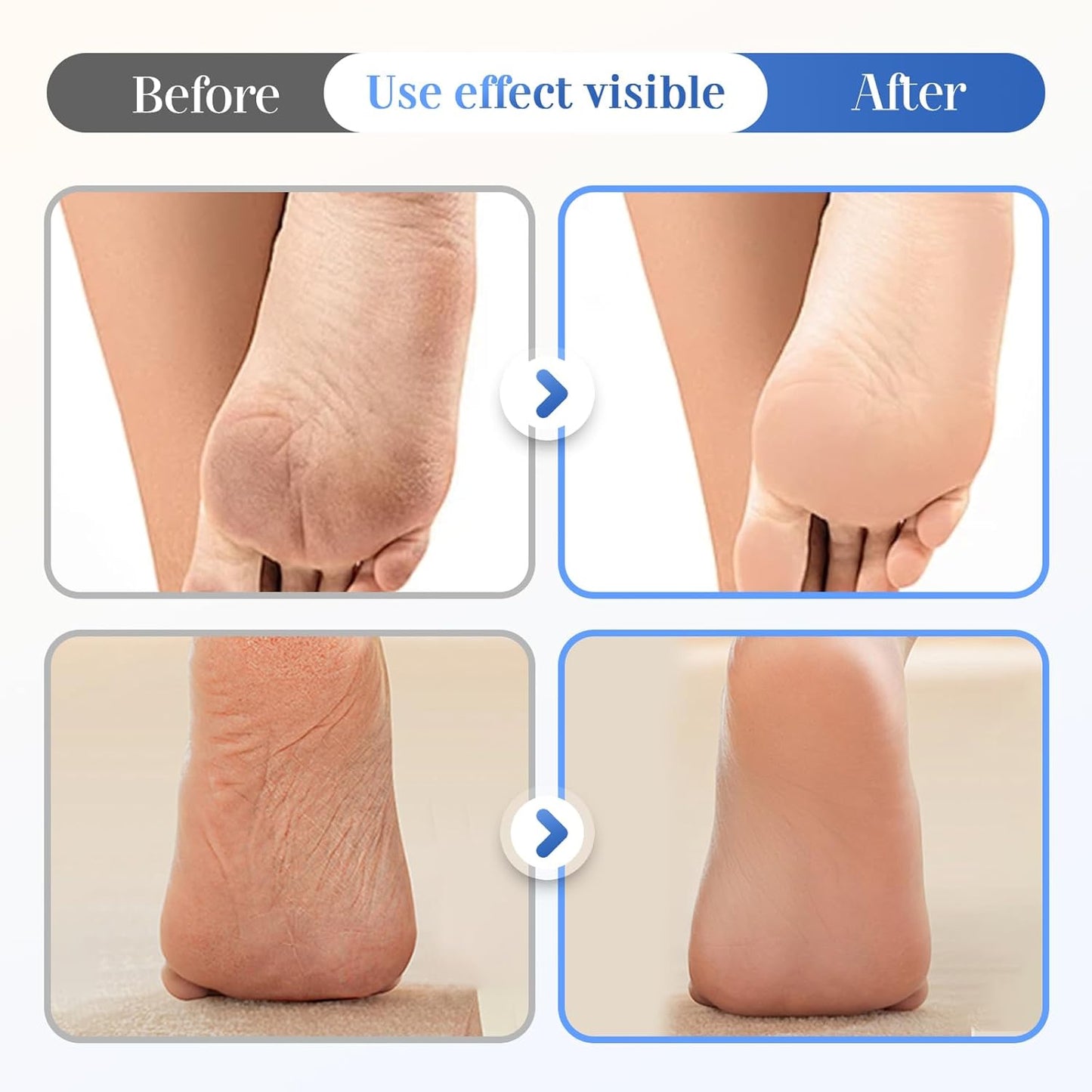 Hydrating Foot Cream - Moisturizing & Anti-Cracking Formula for Dry, Cracked Feet | 2026 Upgrade