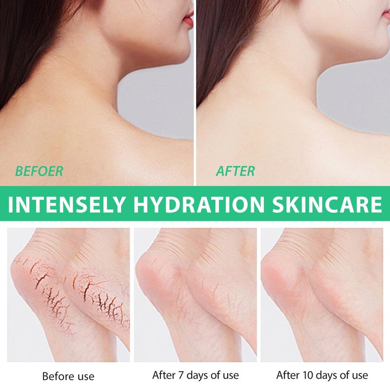 Urea Cream 40 Percent For Feet Maximum Strength,40% Urea Cream Plus 2% Salicylic Acid with Hyaluronic Acid,Tea Tree,and Aloe Vera for Foot and Hand - Deep Moisturizes,Callus Remover 3.53 oz