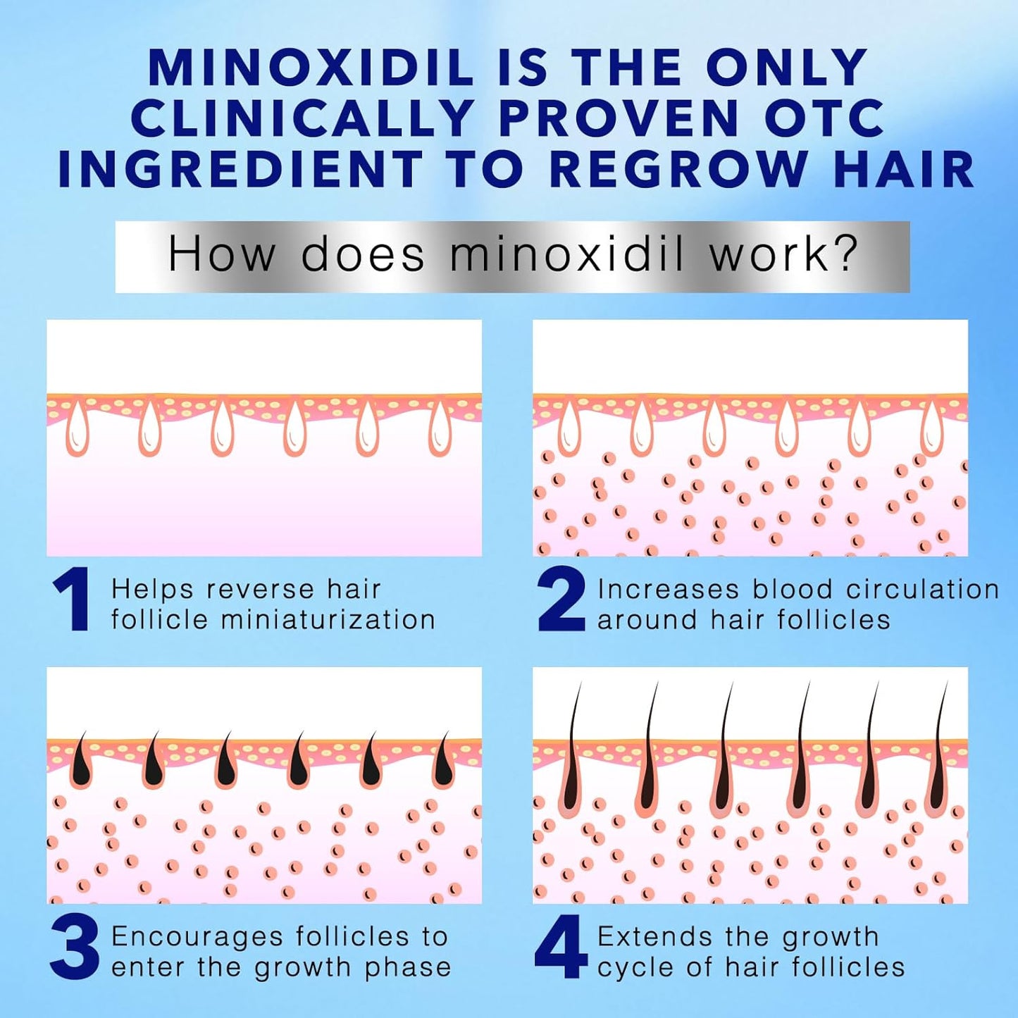 5% Minoxidil Foam for Hair Regrowth | Topical Hair Loss Treatment for Men - 60ml / 2.11oz