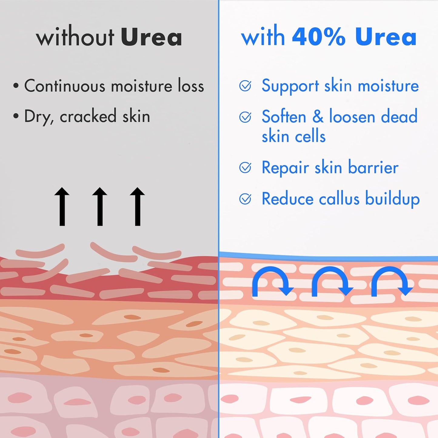Ebanel Urea Cream 40% & Salicylic Acid 2% - Intensive Foot Cream for Dry, Cracked Heels & Skin Repair | 2-Pack