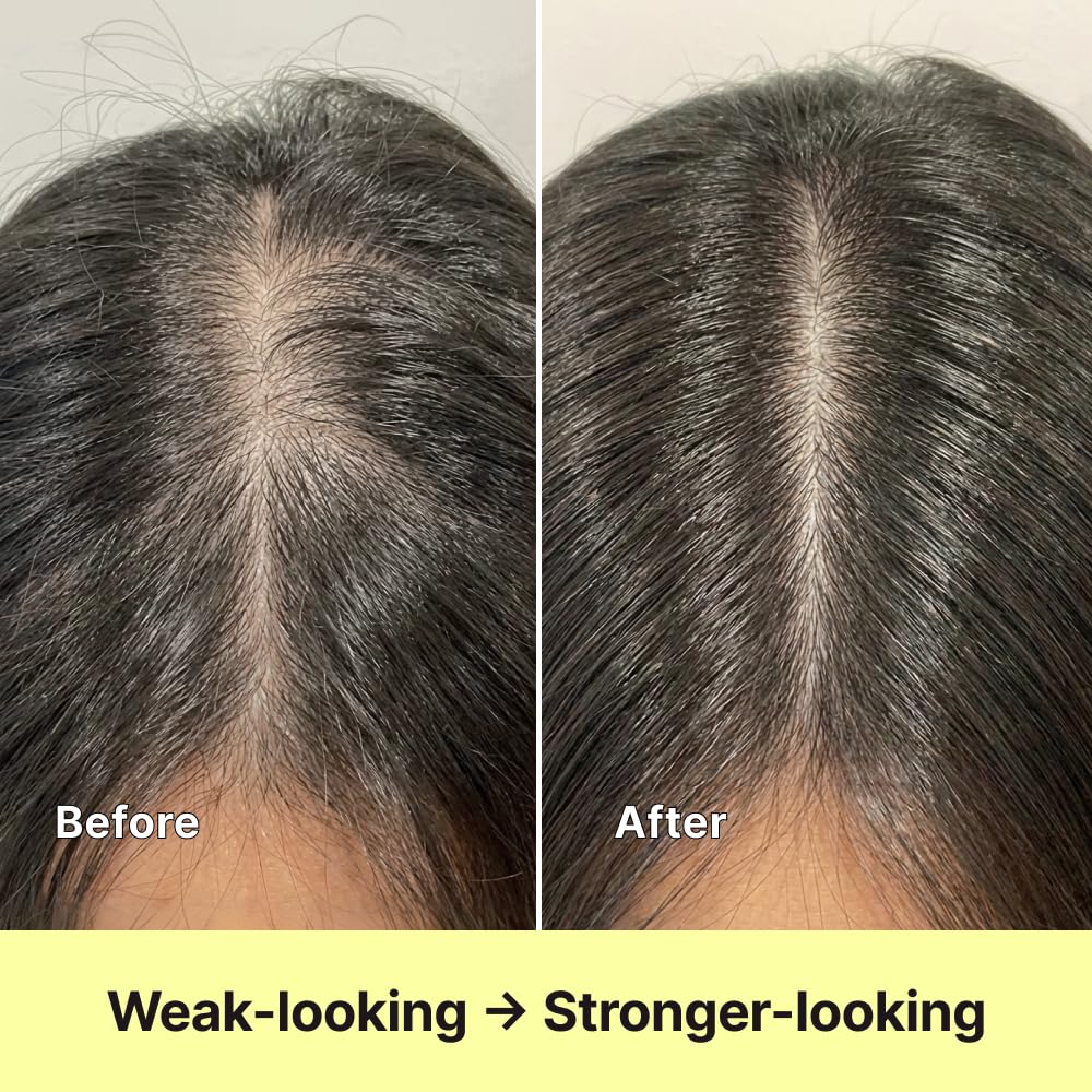 Black Grain Strengthening Shampoo for Thinning Hair - Reduces Breakage & Enhances Scalp Health | 16.9 fl oz / 500ml