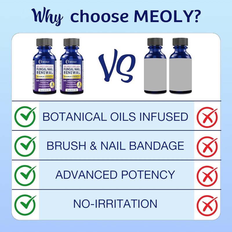 Toenail Fungus Treatment - 30% Undecylenic Acid with Natural Oils | Includes Nail Bandage, File & Brush for Ingrown Nails