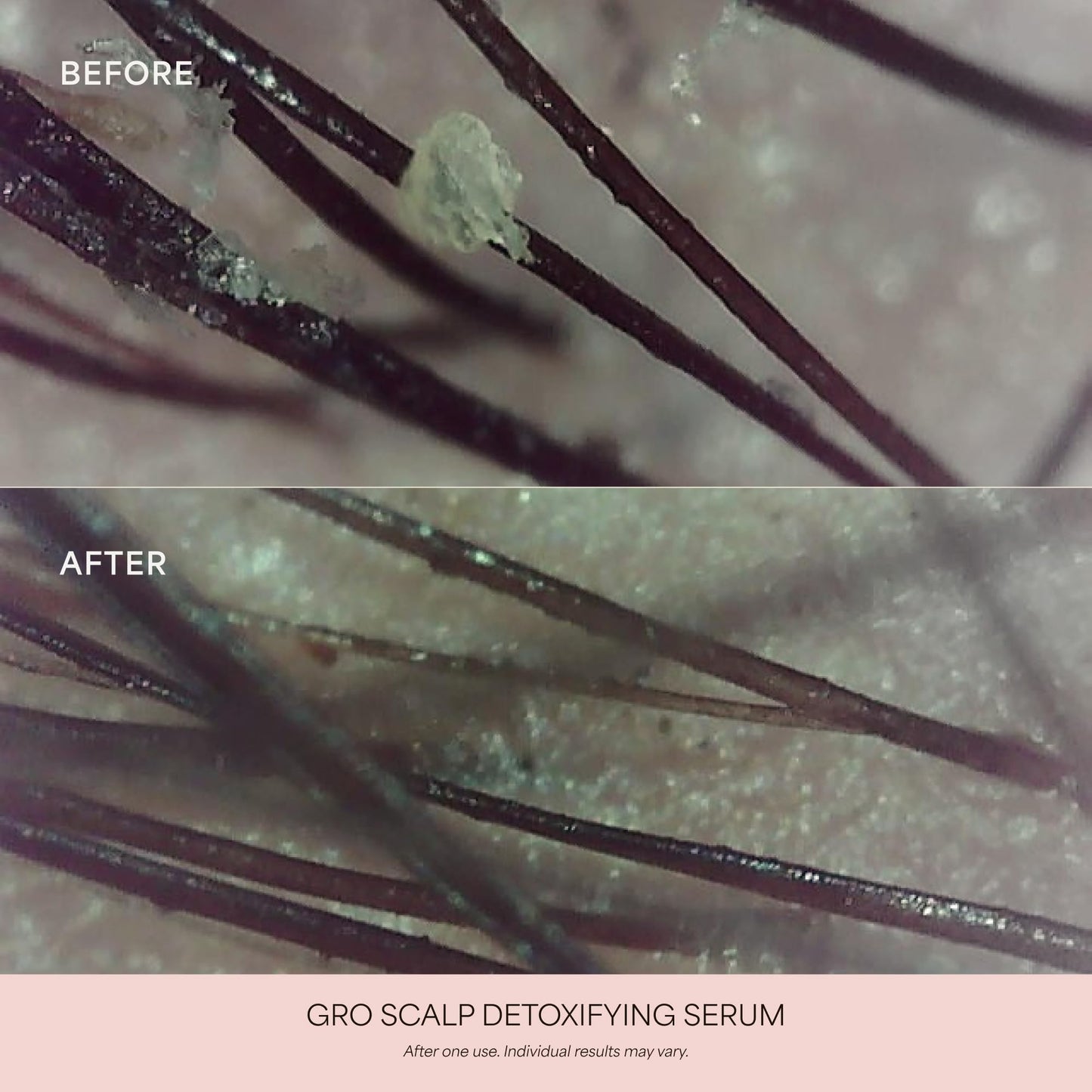 VEGAMOUR GRO Scalp Detoxifying Serum, Scalp Serum with Zinc PCA Removes Buildup & Soothes Scalp, Natural Citrus Scent, 2 fl. oz.