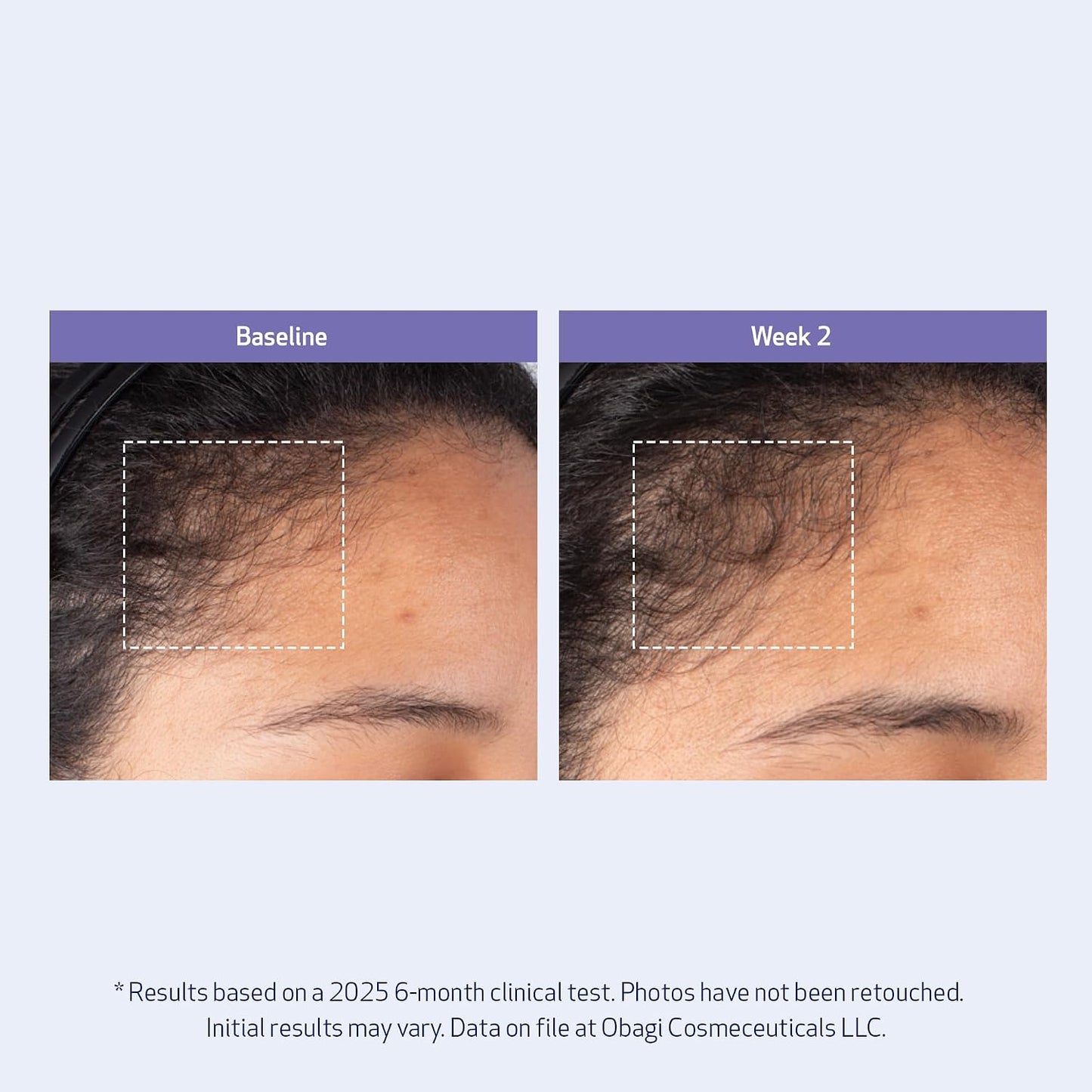 Obagi Nu-Cil BioStim Hair Scalp Serum | Biotin-Infused for Fuller, Denser Hair - Lightweight & Strengthens Follicles - 2 oz