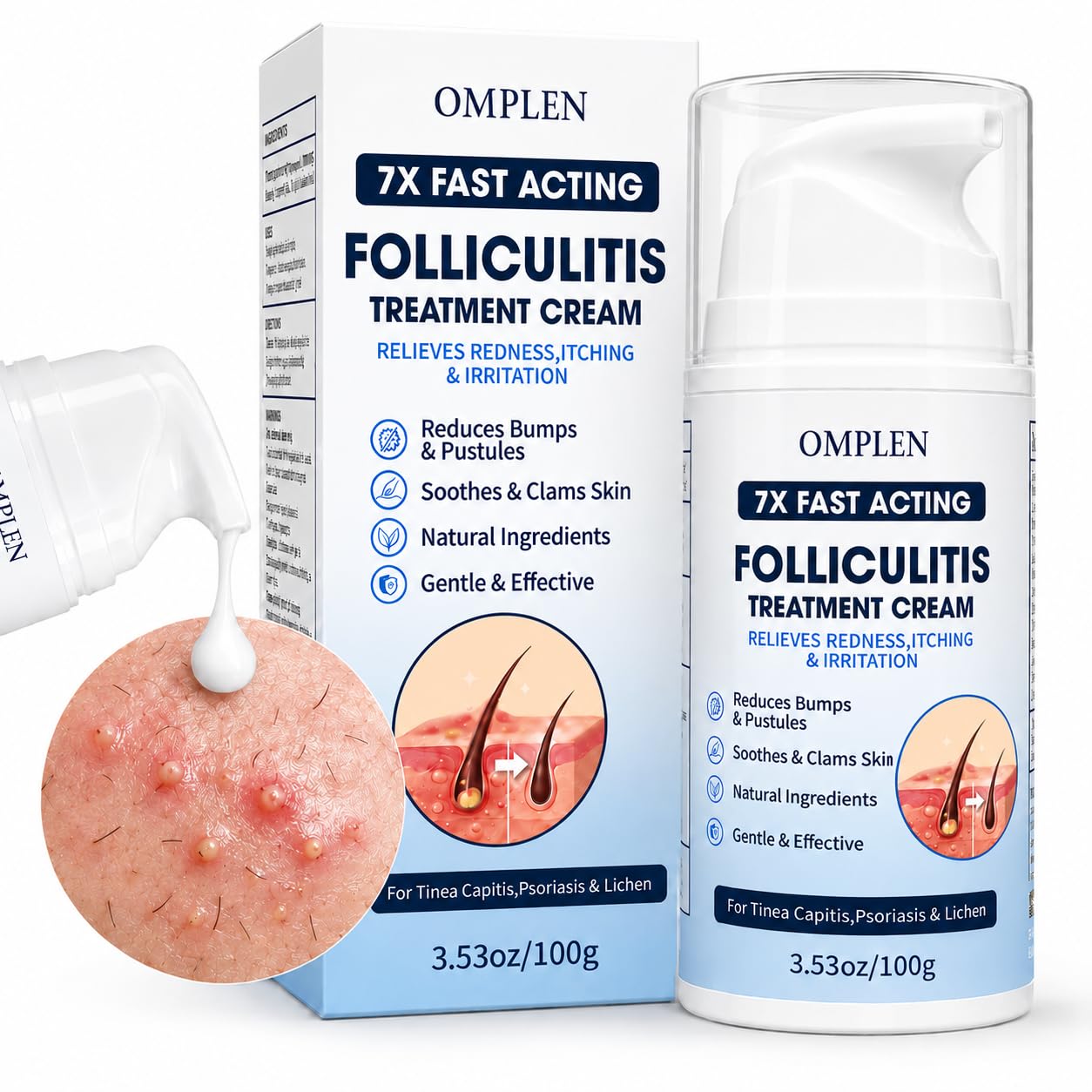 Razor Bumps & Ingrown Hair Folliculitis Treatment Cream – 5% Benzoyl Peroxide for Scalp Bumps & Body Acne – Fast-Acting Relief for Shaving Irritation, Redness & Bumps with Tea Tree & Centella, 3.53 oz