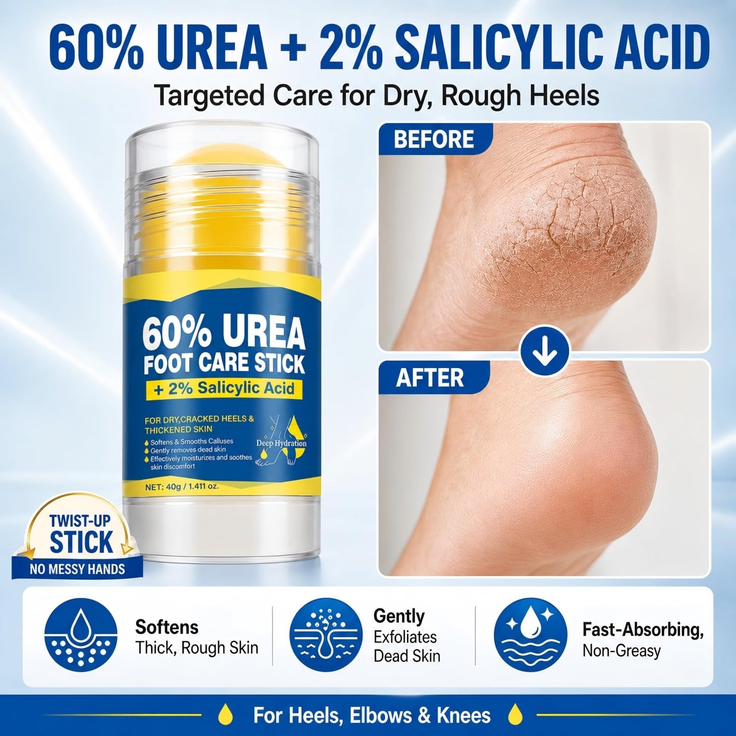 QVCQ 60% Urea Foot Cream Stick with 2% Salicylic Acid, Intensive Heel Balm for Dry Cracked Feet, Rough and Thick Skin, Fast-Absorbing Foot Repair Moisturizer for Heels, Elbows and Knees, 1.41 Oz