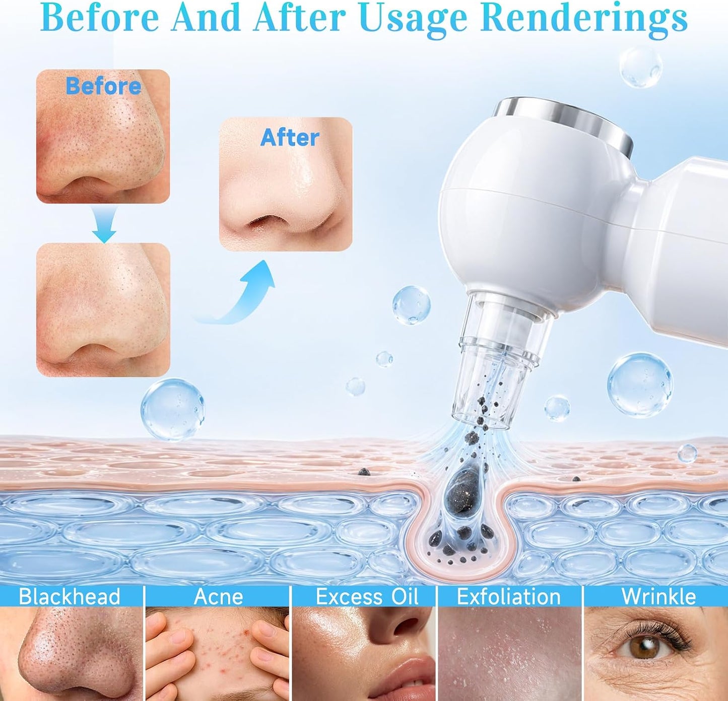 Blackhead Remover Vacuum - 6 Heads Facial Pore Cleaner with 46° Warm Compress | USB-C, 3-Level Suction