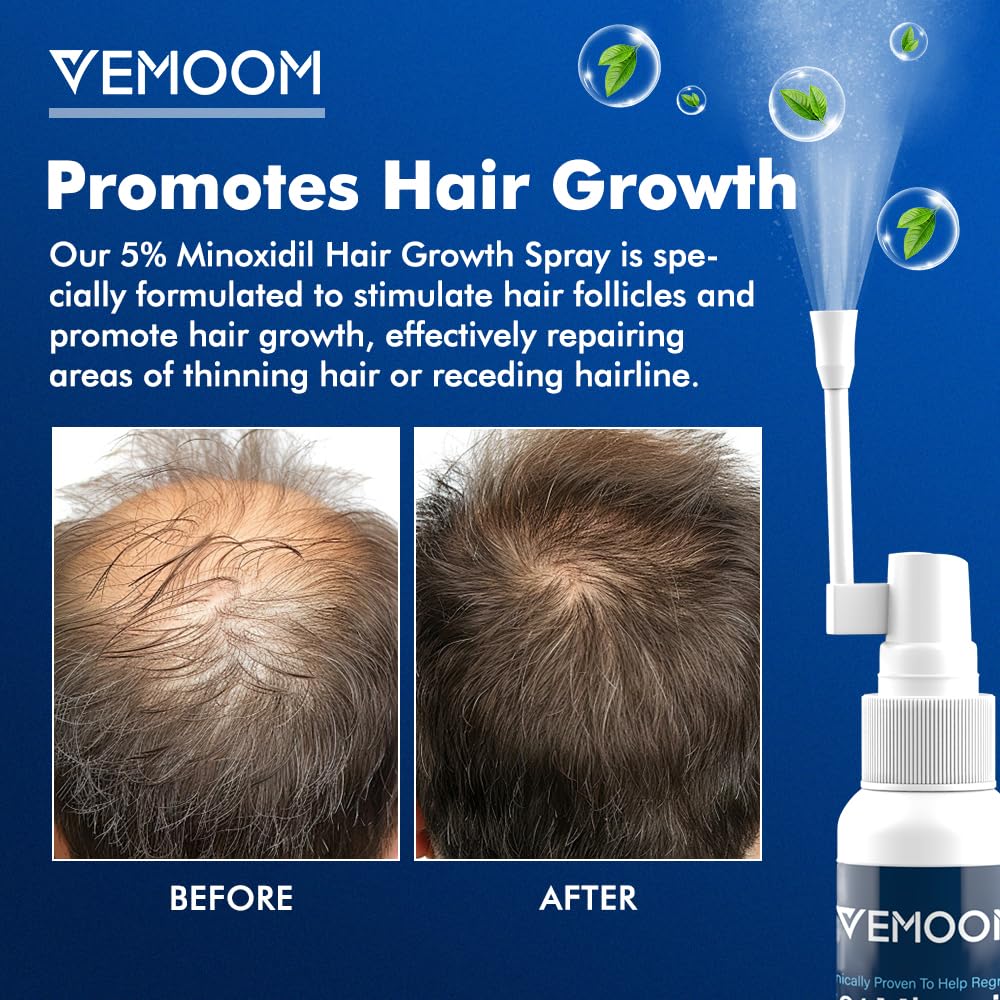 5% Minoxidil Hair Growth Spray for Women and Men, Effective Anti-Hair Loss Treatment for Regrowth, Extra Strength Scalp Solution, Thicker, Stronger and Longer Hair - 60ml*2