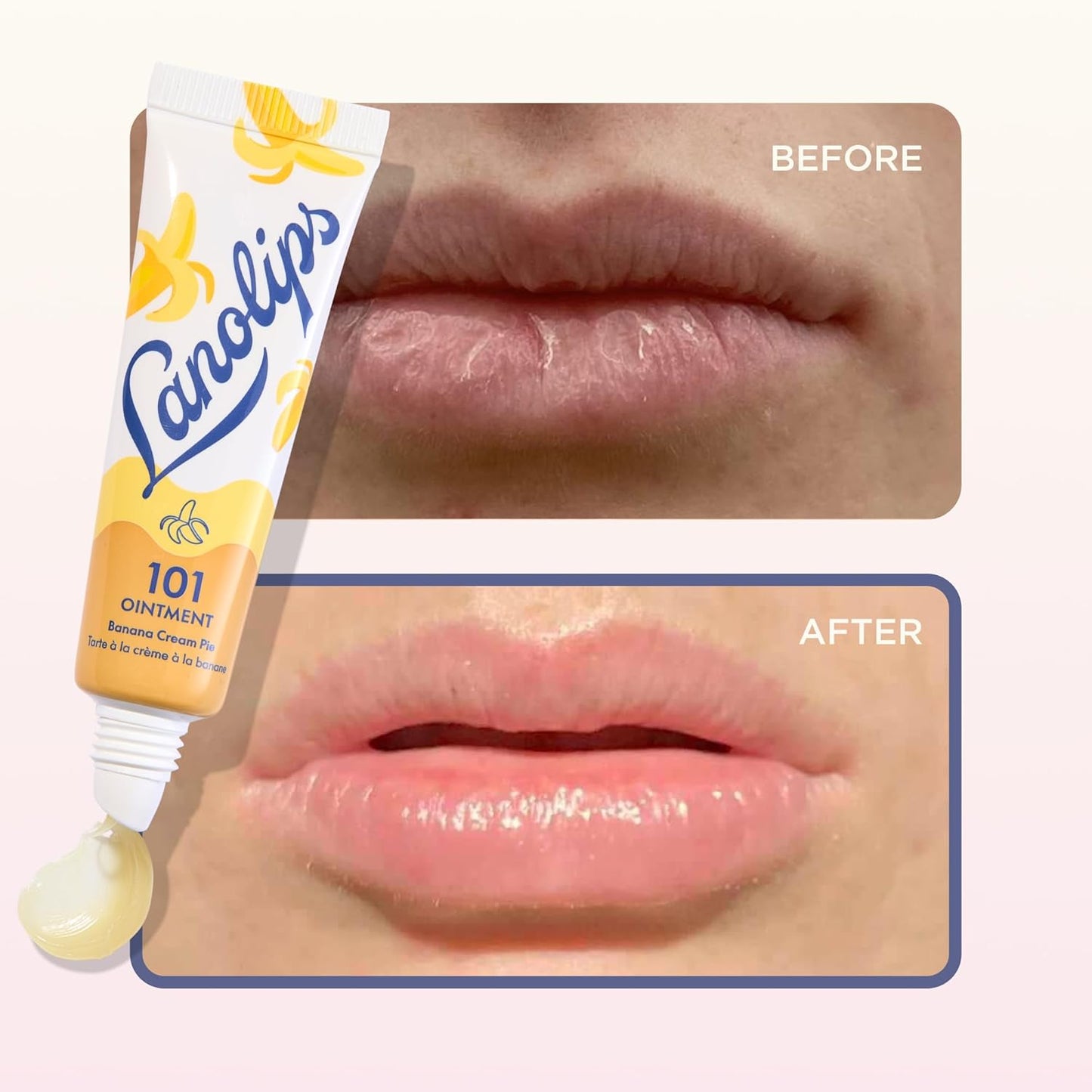 Lanolin 101 Multipurpose Ointment - Healing Lip Balm & Skin Repair Moisturizer | Banana Cream Pie (0.35 oz)
