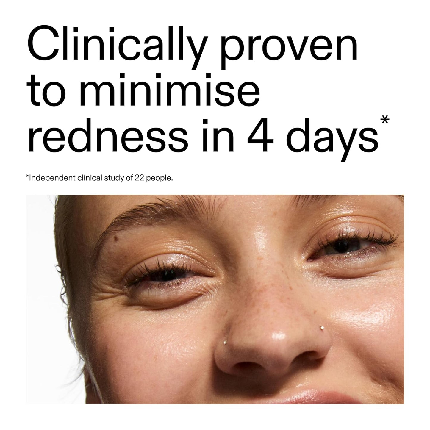 Azelaic Acid 10% Serum - Fast-Absorbing Formula to Reduce Redness & Sooth Skin | 1.01 fl oz
