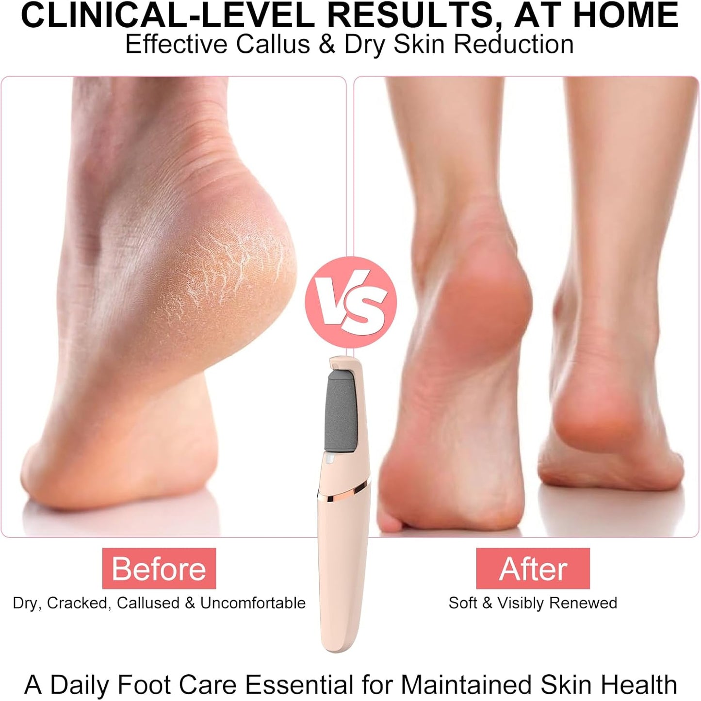 Electric Foot File - Rechargeable Callus Remover for Smooth Feet | 2 Speeds, Waterproof & Cordless Pedicure Tool