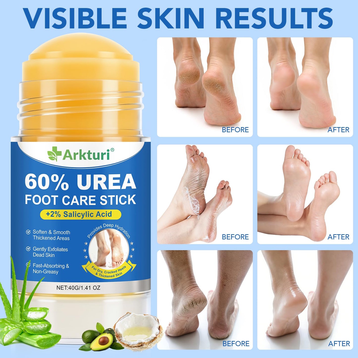 Urea Cream 60% with Salicylic Acid 2% Urea Foot Care Stick, Foot Cream for Dry Cracked Feet, Heels, Knees, Hands, Elbows, Feet Moisturizer Stick for Callus Remover & Skin Softener (40g (Pack of 2))