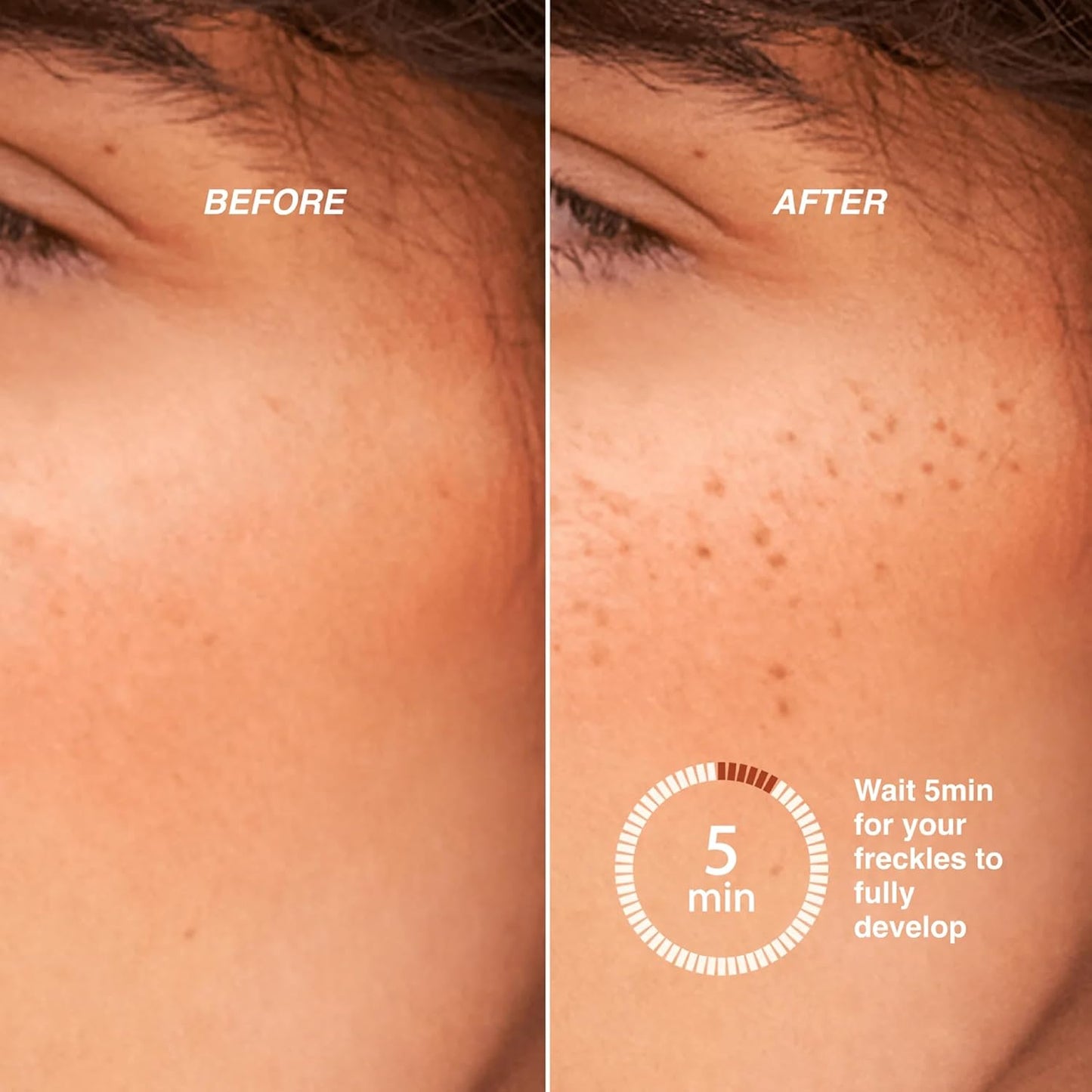 Freck XL Freckle Pen - Buildable Faux Freckles Makeup for Natural Sun-Kissed Look | Vegan, Long-Lasting Formula | Light/Medium Skin Tones