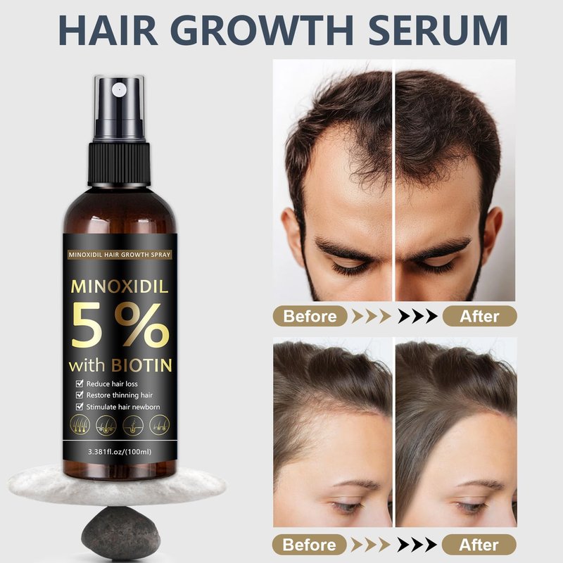 Minoxidil Hair & Beard Growth Spray - Biotin Treatment for Thinning Hair | 3.38 oz, Black