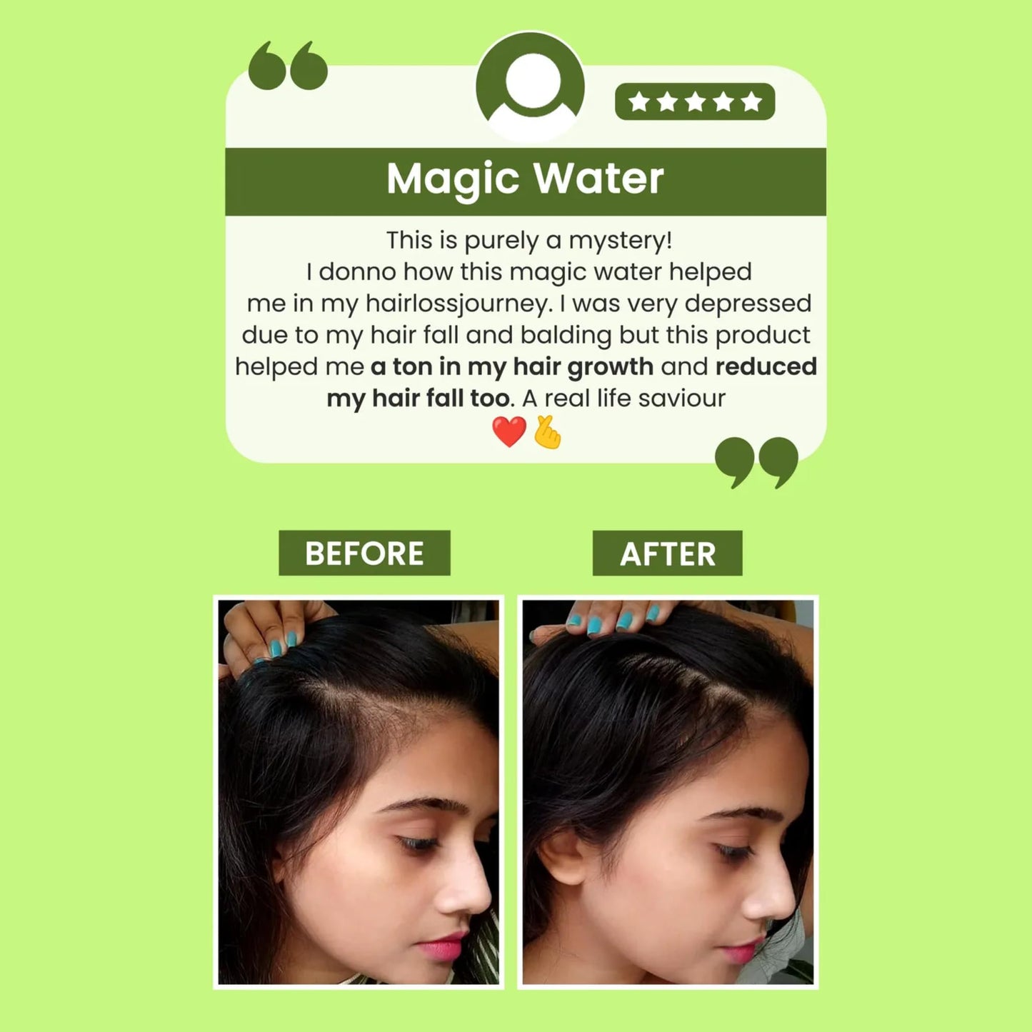 Alps Goodness Rosemary Water Refill Pack | Herbal Hair & Scalp Mist for Thicker-Looking Hair, Shine & Smoothness | Lightweight Non-Greasy Spray | Silicone, Sulfate & Paraben Free | 10.31 Fl Oz (305ml)