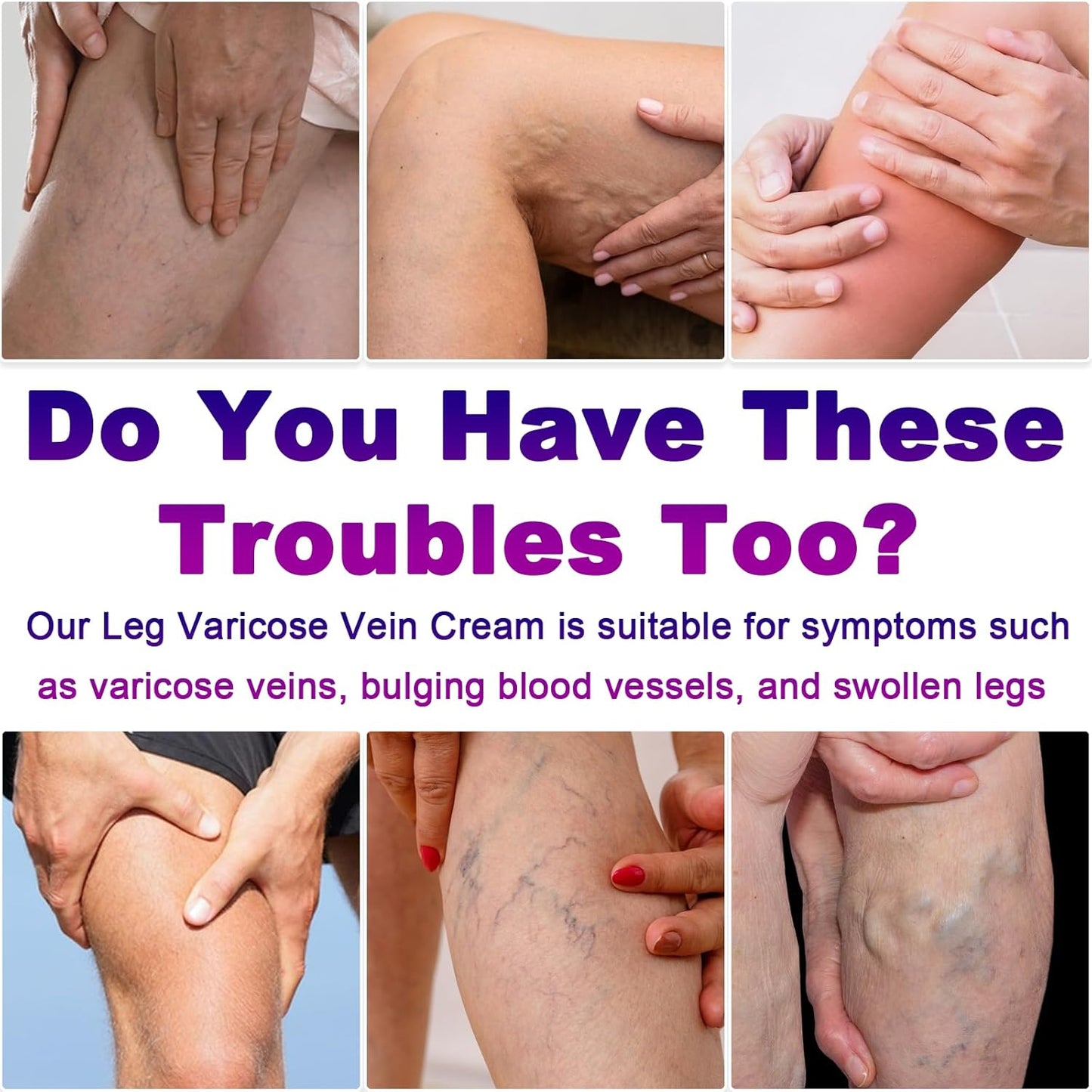Varicose Veins Cream - Spider Veins Treatment for Legs | Improves Circulation & Relieves Fatigue - 1 Pack