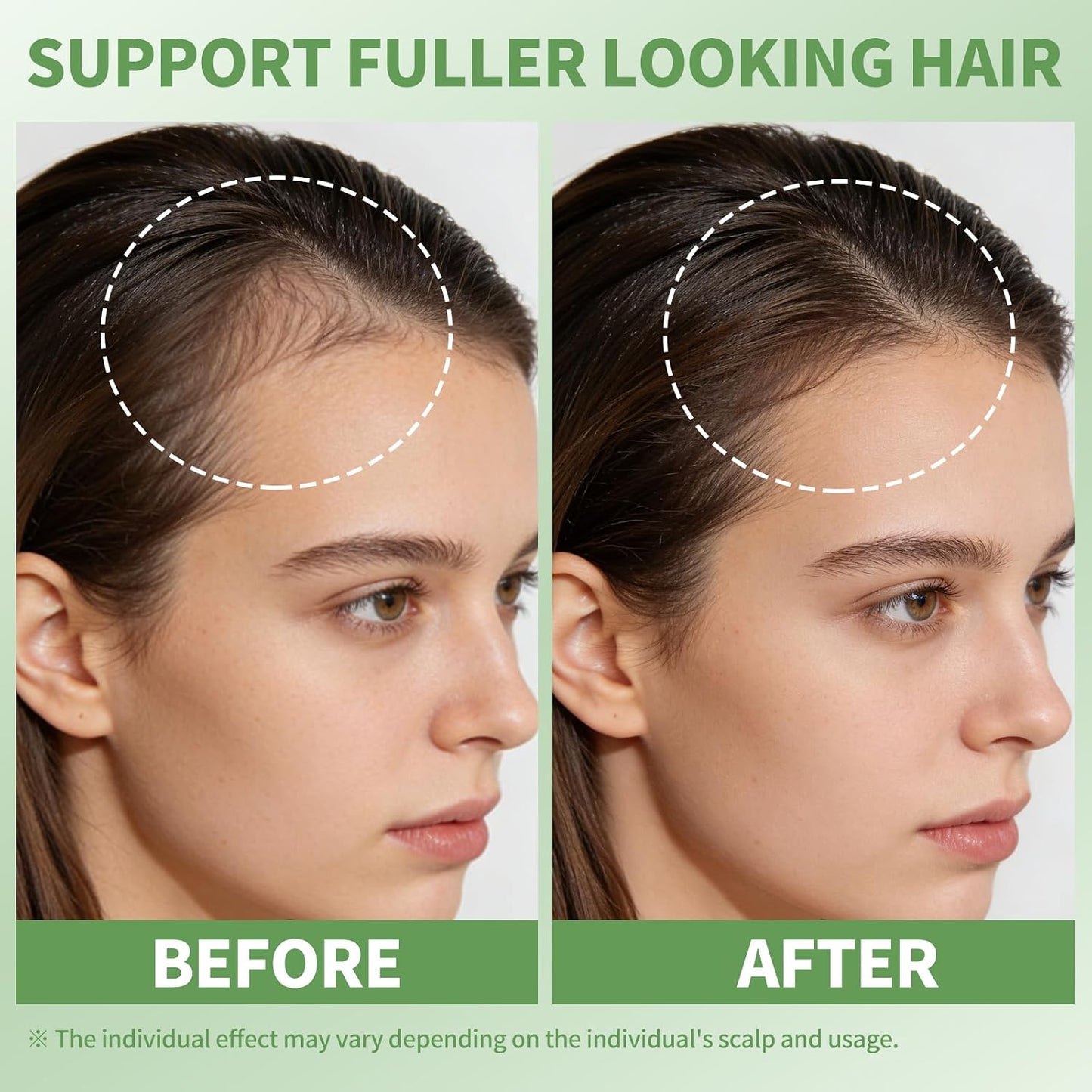 Rosemary Oil Hair Growth Serum - Hydrating Non-Greasy Scalp Treatment | 25ml Roller for Thicker Hair