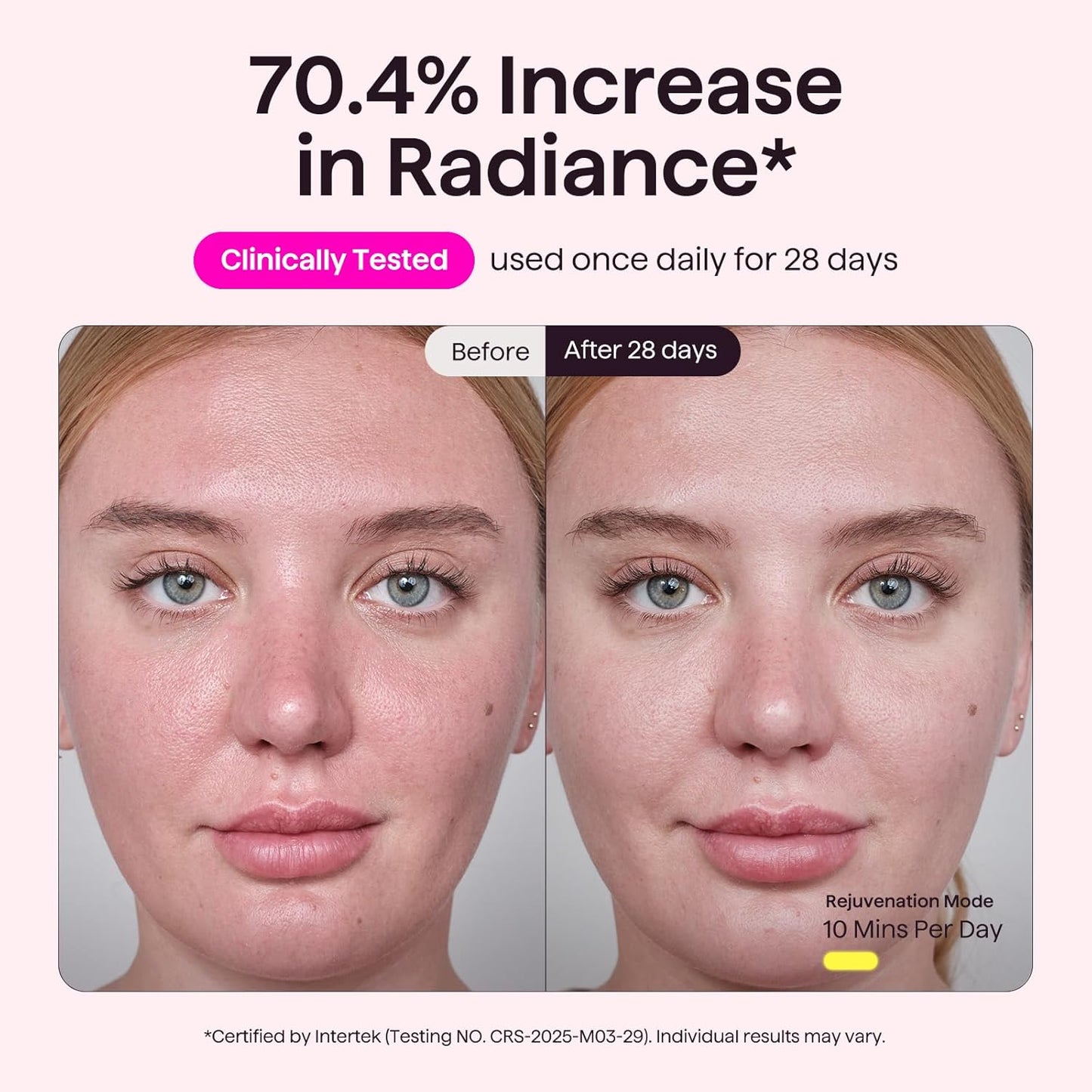 Red Light Therapy Mask for Face - LED Light Therapy for Anti-Fine Lines, Acne Treatment & Skin Rejuvenation | Multi-Color Options