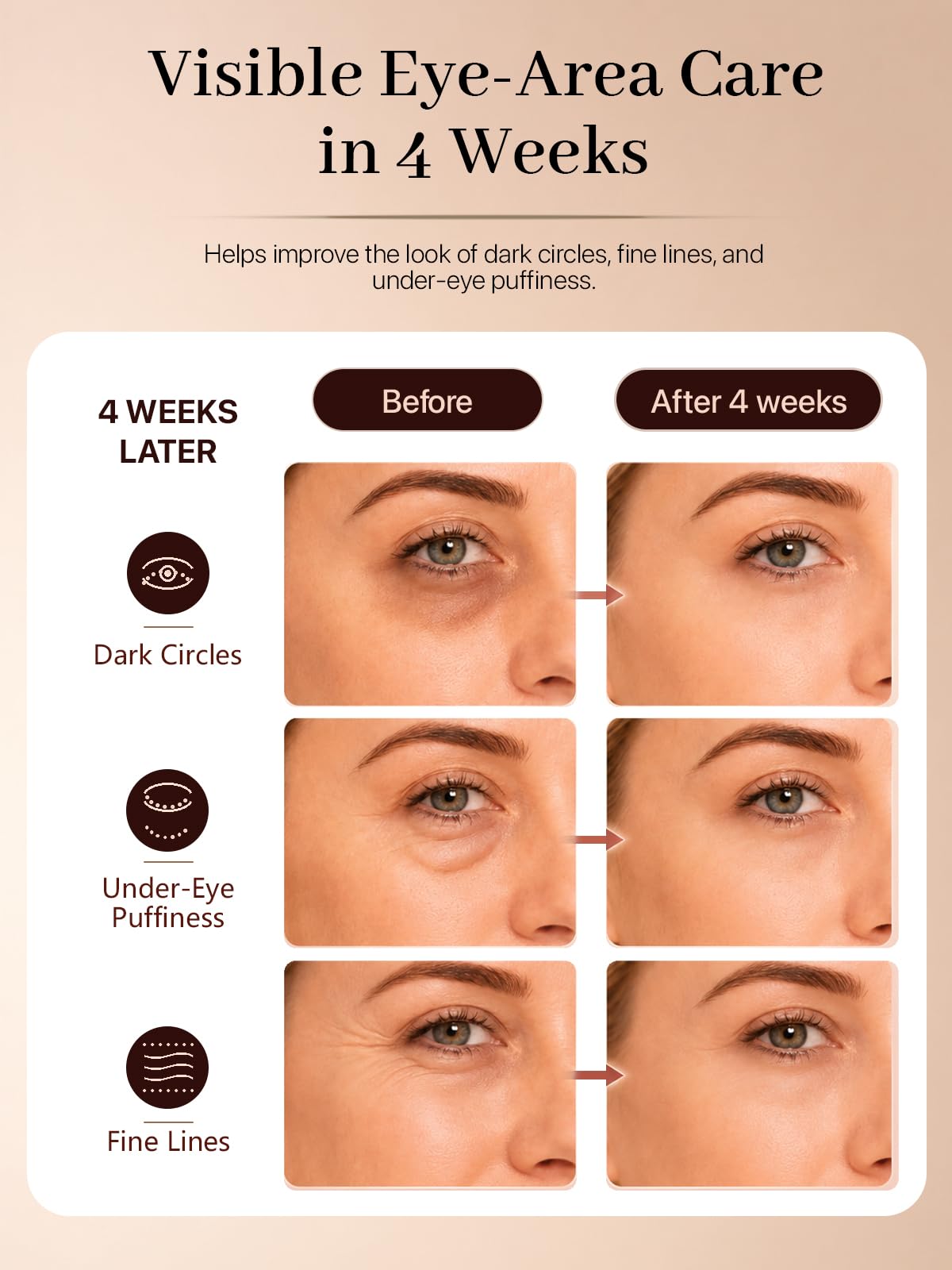 Red Light Therapy for Eyes, Under Eye Red Light Device with 630nm Red & 850nm Near Infrared, Rechargeable Wireless Remote, for Dark Circles, Puffiness, Fine Lines & Screen Fatigue