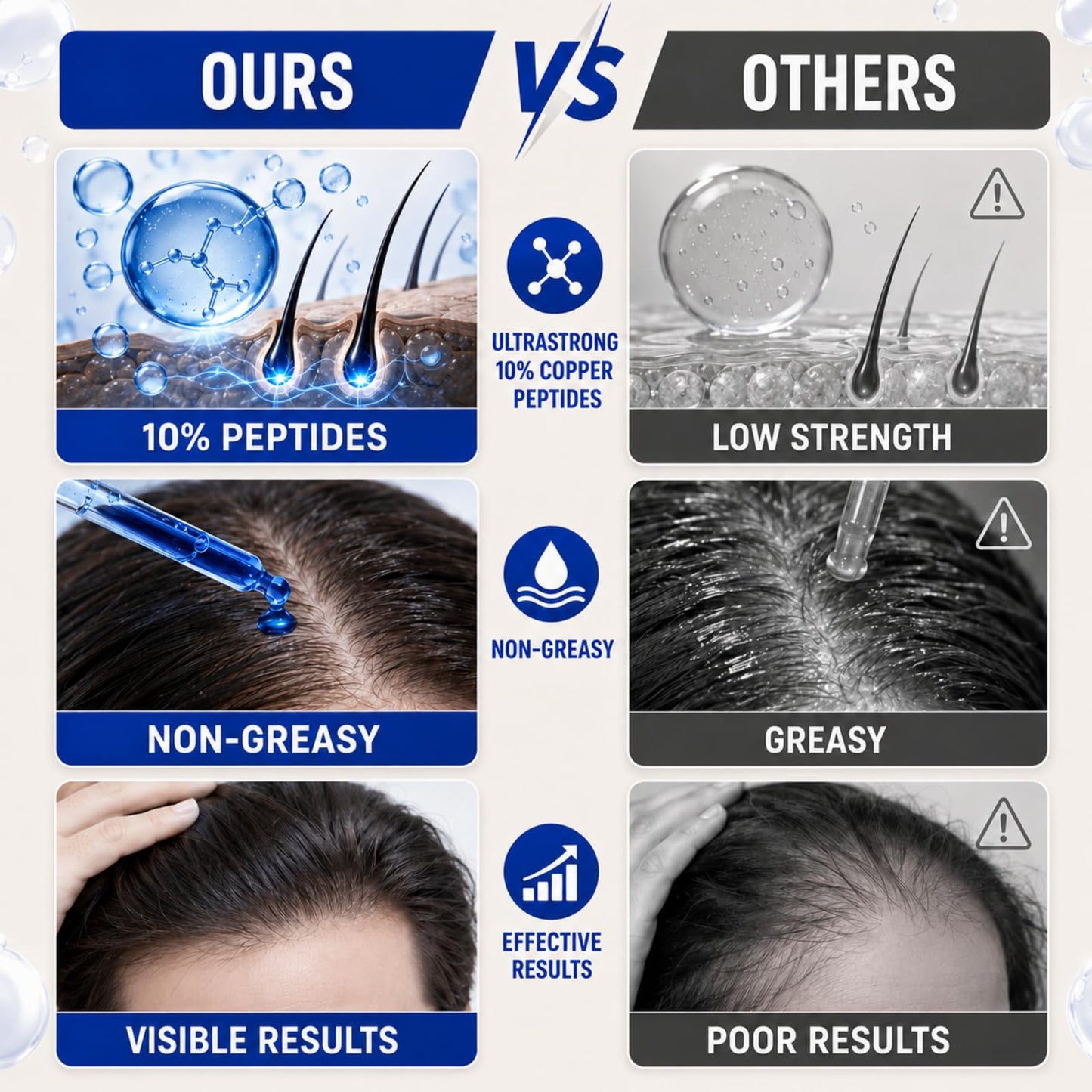 Ultrastrong 10% Copper Peptides for Hair Growth, GHK-Cu Scalp Serum, Water-Based Scalp Treatment for Thinning Hair, Non-Greasy Leave-In Formula with Biotin & Rosemary, For Women & Men, 1 Fl Oz